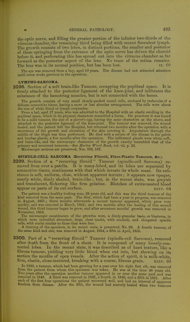 the optic nerve, and filling tlie greater portion of the inferior two-thirds of the vitreous chamber, the remaining third being filled vrith recent flocculent lymph. The growth consists of two lobes, in distinct portions, the smaller and posterior of these springing from the entrance of the optic nerve has driven the choroid before it, and perforating this has spread out into the vitreous chamber as far forward as the posterior aspect of the lens. No trace of the retina remains. The lens was in its normal position, but has been lost. ix. 60 Tlie eye was remoTed from a boy, aged 10 years. The disease had not attracted attention untU seven weeks previous to the operation. LYMPHO-SARCOMA. 3298. Section of a soft brain-like Tumour, occupying the popliteal space. It is firmly attached to the posterior ligament of the knee-joint, and infiltrates the substance of the hamstring muscles, but is not connected with the bones. The growth consists of very small closely-packed round cells, enclosed by trabeculee of a dehcate connective tissue, having a more or less alveolar arrangement. The cells were about the size of white blood or lymph corpuscles. From a lad, aged 17 years, who was admitted to the Hospital with an elastic swelling in the popliteal space, wliich in its physical characters resembled a bursa. On puncture it was found to be a soHd tumour, the size of a plover's egg, having the same characters as the above, and attached to the posterior ligament of the knee-joint. The tumour was removed, the wound healed, and the patient left the Hospital, but returned two months after the operation with a recurrence of the growth and ulceration of the skin covering it. Amputation through the middle of the thigh was then performed. He died with a return of the disease in the pelvic and lumbar glands, a few months after the operation. The infiltrated glands were white, soft, and brain-like, and the microscopic characters of the growth exactly resembled that of the primary and recun-ent tumours.—See Sarley Ward Book, vol. vii, p. 22. Microscopic sections are preserved, Nos. 166, 167. SPINDIiE-CELL SABCOMA (Recurring- Fibroid, FiTbro-Plastic Tumours, &c.). 3299. Section of a  recurring fibroid Tumour (spindle-cell Sarcoma) re- moved from over a patella. It is many-lobed, and its lobes are separated by connective tissue, continuous with that which invests its whole mass. Its sub- stance is soft, uniform, close, without apparent texture ; it appears now opaque, nearly white, dimly shaded, brain-like ; but, in the recent state, was greyish and translucent, flickering like firm gelatine. Blotches of extravasated blood appear on parts of its cut surface. xxxv. 64 The patient was a healthy-looking man, 23 years old, and this was the third tumour of the kind removed from the same part. The first, which had been a year in progress, was removed in August, 1851; three months afterwards a second tumour appeared, which grew very quickly, and was removed in March, 1852; and two months after the healing of this second wound, this third tumour began to grow, and after seventeen months' growth was removed in November, 1853. The microscopic constituents of the growths were, a dimly-granular basis, or blastema, in which were imbedded abundant, large, clear nuclei, with nucleoli, and elongated spindle cells, with nuclei similar to those that were free. A drawing of the specimen, in its recent state, is preserved, No. 56. A fourth tumour, of the same kind and size, was removed in August, 1854, a fifth in April, 1855. 3300. Part of a recurring fibroid Tumour (spindle-cell Sarcoma), removed after death from the front of a chest. It is composed of many loosely-con- nected lobes. In the recent state, it was described as of hard texture, like a fibrous tumour, yielding very little blood when cut into, but showing on its section the mouths of open vessels. After the action of spirit, it is milk-white, firm, elastic, close-textured, breaking with a coarse, fibrous grain. xxxv. 80 In 1839, a tumour, which had been growing for a year over his right first rib, was removed from the patient from whom this specimen was taken. He was at the time 48 years old. Two years after the operation another tumour appeared in or near the same part aud was removed in 1843, A third was removed in 1847, a fourth in 1849, and a fifth in 1851. After each of the first four operations the patient recovered well, and had an interval of apparent freedom from disease. After the fiilh, the wound had Bcarcely healed when two tumours