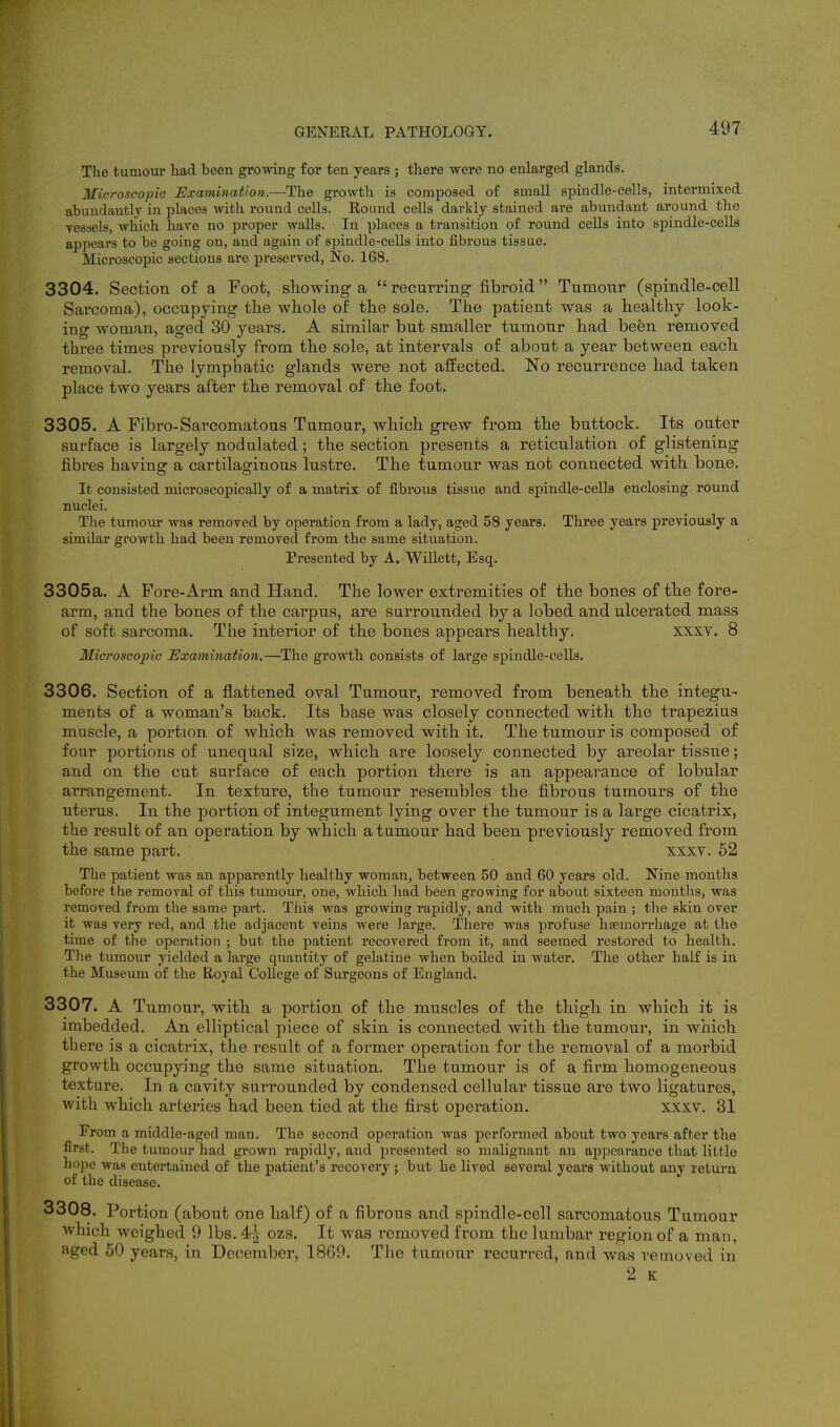 The tumour had been growing for ten years ; there were no enlarged glands. Microscopic Examination.—The growth is composed of small spindle-cells, intermixed abuudantlv in places with round cells. Round cells darkly stained are abundant around the Tcssels, which have no proper walls. In places a transition of round cells into spindlc-celLs appears to be going on, and again of spindle-cells into fibrous tissue. Microscopic sections are preserved, No. 168. 3304. Section of a Foot, stowing a recurring fibroid Tumour (spindle-cell Sarcoma), occupying the whole of the sole. The patient was a healthy look- ing woman, aged 30 years. A similar but smaller tumour had been removed three times previously from the sole, at intervals of about a year between each removal. The lymphatic glands were not affected. No recurrence had taken place two years after the removal of the foot. 3305. A Fibro-Sarcomatous Tumour, which grew from the buttock. Its outer surface is largely nodulated; the section presents a reticulation of glistening fibres having a cartilaginous lustre. The tumour was not connected with bone. It consisted microscopically of a matrix of fibrous tissue and spindle-cells enclosing round nuclei. The tumour was removed by operation from a lady, aged 58 years. Three years previously a similar growth had been removed from the same situation. Presented by A. Willett, Esq. 3305a. A Fore-Arm and Hand. The lower extremities of the bones of the fore- arm, and the bones of the cai'pus, are surrounded by a lobed and ulcerated mass of soft sarcoma. The interior of the bones appears healthy. xxxv. 8 Microscopic JExamination.—The growth consists of large spindle-cells. 3306. Section of a flattened oval Tumour, removed from beneath the integu- ments of a woman's back. Its base was closely connected with the trapezius muscle, a portion of which was removed with it. The tumour is composed of four portions of unequal size, which are loosely connected by areolar tissue; and on the cut surface of each portion there is an appearance of lobular arrangement. In texture, the tumour resembles the fibrous tumours of the uterus. In the portion of integument lying over the tumour is a large cicatrix, the result of an operation by which a tumour had been previously removed from the same part. xxxv. 52 The patient was an apparently healthy woman, between 50 and 60 years old. Nine months before the removal of this tumour, one, which had been growing for about sixteen months, was removed from the same part. This was growing rapidly, and with much pain ; the skin over it was very red, and the adjacent veins were large. There was profuse hsemorrhage at the time of the operation ; but the patient recovered from it, and seemed restored to health. Tlie tumour yielded a large quantity of gelatine when boiled in water. The other half is in the Museum of the Royal College of Surgeons of England. 3307. A Tumour, with a portion of the muscles of the thigh in which it is imbedded. An elliptical piece of skin is connected with the tumour, in which there is a cicatrix, the result of a former operation for the removal of a morbid growth occupying the same situation. The tumour is of a firm homogeneous texture. In a cavity surrounded by condensed cellular tissue are two ligatures, with which arteries had been tied at the first operation. xxxv. 31 From a middle-aged man. The second operation was performed about two years after the first. The tumour had grown rapidly, and presented so malignant an appearance that little hope was entertained of the patient's recovery ; but he lived several years without any return of the disease. 3308. Portion (about one half) of a fibrous and spindle-cell sarcomatous Tumour which weighed 9 lbs. 4| ozs. It was i^emoved from the lumbar region of a man, aged 50 years, in December, 1869. The tumour recurred, and was removed in 2 K
