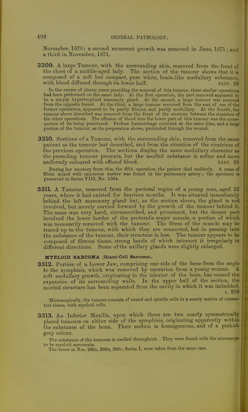 November, 1870; a second recurrent gro-wth was removed in Jnne, 1871; and a third in November, 1871. 3309. A large Tumour, vpith the surrounding skin, removed from the front of the chest of a middle-aged lady. The section of the tumour shows that it is composed of a soft but compact, pure white, brain-like medullary substance, with blood diffused through its lower half. xxxv. 28 In tlie course of eleven years preceding the removal of this tumour, three similar operations had been performed on the same lady. At the first operation, the part removed appeared to be a simply hypertropliied mammary gland. At the second, a large tumour was removed from the opposite breast. At the third, a large tumour removed from the seat of one of the former opei-ations, appeared to be jmrtly fibrous, and partly medullary. At the fourtli, the tumour above described was removed from the front of the sternum between the cicatrices of the other operations. The effusion of blood into the lower part of this tumour was the conse- quence of its being punctured. Profuse hsemorrhage occurred at the same time, and a large portion of the tumour, as the preparation shows, protruded through the wound. 3310. Sections of a Tumour, with the surrounding skin, removed from the same patient as the tumour last described, and from the situation of the cicatrices of the previous operation. The sections display the same medullary character as the preceding tumour presents, but the morbid substance is softer and more uniformly coloured with effused blood, xxxv. 29 During her recovery from this, the fifth operation, the patient died suddenly. A mass of fibrin mixed with cancerous matter was found in the pulmonary artery j the specimen is preserved in Series VIII, No. 1564. 3311. A Tumour, removed from the pectoral region of a young man, aged 22 years, where it had existed for fourteen months. It was situated immediately behind the left mammary gland but, as the section shows, the gland is not involved, but merely carried forward by the growth of the tumour behind it. The mass was very hard, circumscribed, and prominent, but the deeper part involved the lower border of the pectoralis major muscle, a portion of which was necessarily removed with the tumour. The iibres of the mnscle may be traced up to the tumour, with which they are connected, but in passing into the substance of the tumour, their structure is lost. The tumour appears to be composed of fibrous tissue, strong bands of which intersect it irregularly in different directions. Some of the axillary glands were slightly enlarged. MYEIiOID SARCOMA (aiant-Cell Sarcoma). 3312. Portion of a Lower Jaw, comprising one side of the bone from the angle to the symphisis, which was removed by operation from a young woman. A soft medullary growth, originating in the interior of the bone, has caused the expansion of its surrounding walls. In the upper half of the section, the morbid structure has been separated from the cavity in which it was imbedded. I. 208 Microscopically, the tumour consists of round and spindle cells in a scanty matrix of connec- tive tissue, with myeloid cells. 3313. An Inferior Maxilla, upon which there are two nearly symmetrically placed tumours on either side of the symphisis, originating apparently within the substance of the bone. Their section is homogeneous, and of a pinkish grey colour. The substance of the tumours is ossified throughout. They were found with the microscope to be myeloid sarcomata. The bones in Nos. 289a, 289b, 289c, Series I, were taken from the same case. I i