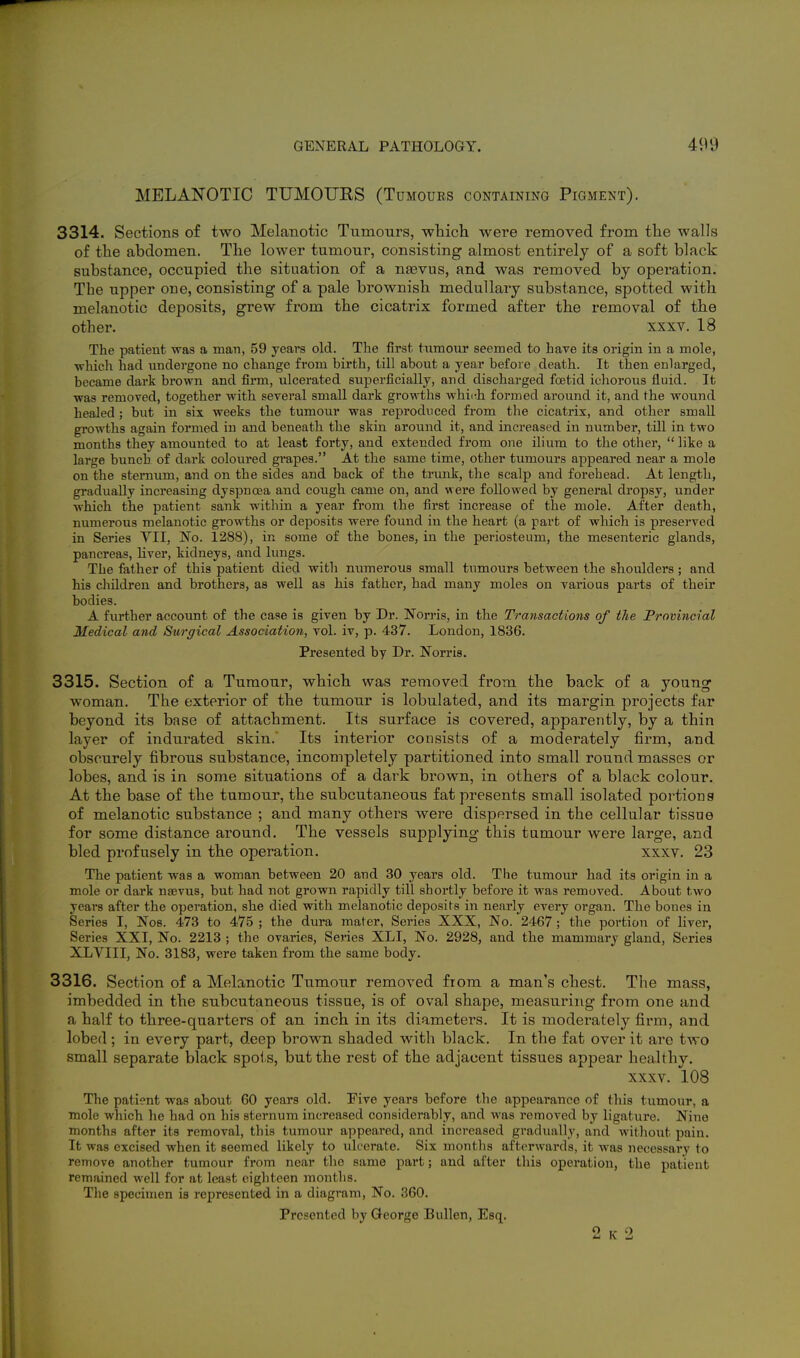 MELANOTIC TUMOTJES (Tumours containing Pigment). 3314. Sections of two Melanotic Tumours, which were removed from the walls of the abdomen. The lower tumour, consisting almost entirely of a soft black substance, occupied the situation of a nasvus, and was removed by operation. The upper one, consisting of a pale brownish medullary substance, spotted with melanotic deposits, grew from the cicatrix formed after the removal of the other. XXXV. 18 The patieut was a man, 59 years old. The first tiimour seemed to have its origin in a mole, which had undergone no change from birth, till about a year before death. It then enlarged, became dai'k brown and firm, ulcerated superficially, and discharged foetid ichorous fluid. It was removed, together with several small dark growths whiith formed around it, and the wound healed ; but in six weeks the tumour was reproduced from the cicatrix, and other small growths again formed in and beneath the skin around it, and increased in number, till in two months they amounted to at least forty, and extended from one ilium to the other,  like a large bunch of dark coloured grapes. At the same time, other tumours appeared near a mole on the sternum, and on the sides and back of the trunk, the scalp and forehead. At length, gradually increasing dyspnoea and cough came on, and were followed by general dropsy, under which the patient sank within a year from the first increase of the mole. After death, numerous melanotic growths or deposits were found in the heart (a part of which is preserved in Series VII, No. 1288), in some of the bones, in the periosteum, the mesenteric glands, pancreas, Uver, kidneys, and lungs. The father of this patient died with numerous small tumours between the shoulders ; and his childreu and brothers, as well as his father, had many moles on various parts of their bodies. A further account of the case is given by Dr. Norris, in the Transactions of the Provincial Medical and Surgical Association, vol. iv, p. 437. London, 1836. Presented by Dr. Norris. 3315. Section of a Tumour, which was removed from the back of a young woman. The exterior of the tumour is lobulated, and its margin projects far beyond its base of attachment. Its surface is covered, apparently, by a thin layer of indurated skin.' Its interior consists of a moderately firm, and obscurely fibrous substance, incompletely partitioned into small round masses or lobes, and is in some situations of a dark brown, in others of a black colour. At the base of the tumour, the subcutaneous fat presents small isolated portions of melanotic substance ; and many others were dispersed in the cellular tissue for some distance around. The vessels supplying this tumour were large, and bled profusely in the operation. xxxv. 23 The patient was a woman between 20 and 30 years old. The tumour had its origin in a mole or dark nsevus, but had not grown rapidly till shortly before it was removed. About two years after the operation, she died with melanotic deposits in nearly every organ. The bones in Series I, Nos. 473 to 475 ; the dura mater, Series XXX, No. 2467; the portion of liver. Series XXI, No. 2213 ; the ovaries. Series XLI, No. 2928, and the mammary gland. Series XLVIII, No. 3183, were taken from the same body. 3316. Section of a Melanotic Tumour removed from a man's chest. The mass, imbedded in the subcutaneous tissue, is of oval shape, measuring from one and a half to three-quarters of an inch in its diameters. It is moderately firm, and lobed; in every part, deep brown shaded with black. In the fat over it are two small separate black spoi s, but the rest of the adjacent tissues appear healthy. xxxv. 108 The patient was about 60 years old. Five years before the appearance of this tumour, a mole which he had on his sternum increased considerably, and was removed by ligature. Nino months after its removal, this tumour appeared, and increased gradually, and without pain. It was excised when it seemed likely to ulcerate. Six months afterwards, it was necessary to remove another tumour from near the same part; and after this operation, the patient remained well for at least cigliteen months. Tlie specimen is represented in a diagram. No. 360. Presented by George Bullen, Esq.