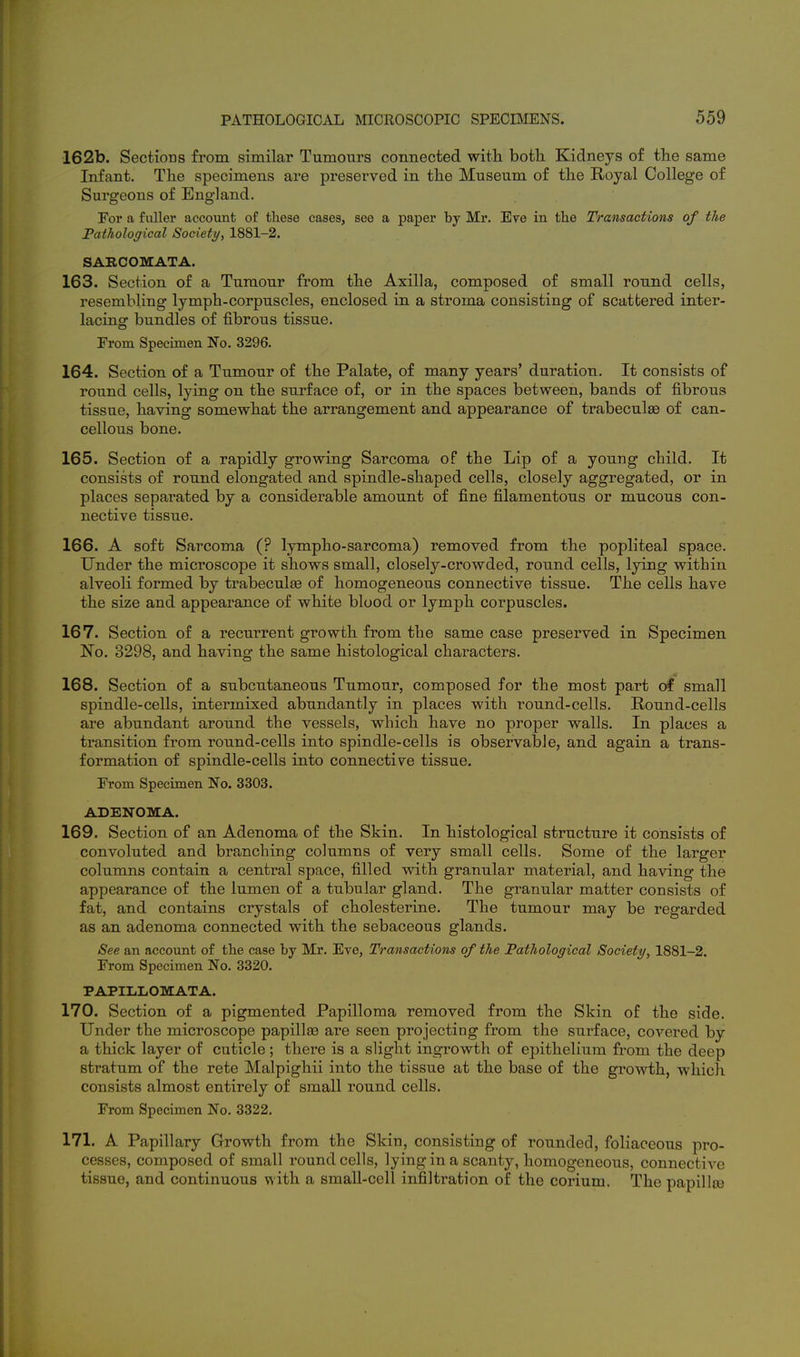 162b. Sections from similar Tumours connected with both Kidneys of the same Infant. The specimens are preserved in the Museum of the Royal College of Surgeons of England. For a fuller account of these cases, see a paper by Mr. Ere in the Transactions of the Pathological Society, 1881-2. SAECOMATA. 163. Section of a Tumour from the Axilla, composed of small round cells, resembling lymph-corpuscles, enclosed in a stroma consisting of scattered inter- lacing bundles of fibrous tissue. From Specimen No. 3296. 164. Section of a Tumour of the Palate, of many years' duration. It consists of round cells, lying on the surface of, or in the spaces between, bands of fibrous tissue, having somewhat the arrangement and appearance of trabeculse of can- cellous bone. 165. Section of a rapidly growing Sarcoma of the Lip of a young child. It consists of round elongated and spindle-shaped cells, closely aggregated, or in places separated by a considerable amount of fine filamentous or mucous con- nective tissue. 166. A soft Sarcoma (? lympho-sarcoma) removed from the popliteal space. Under the microscope it shows small, closely-crowded, round cells, lying within alveoli formed by trabeculse of homogeneous connective tissue. The cells have the size and appearance of white blood or lymph corpuscles. 167. Section of a recurrent growth from the same case preserved in Specimen No. 3298, and having the same histological characters. 168. Section of a subcutaneous Tumour, composed for the most part of small spindle-cells, intermixed abundantly in places with round-cells. Round-cells are abundant around the vessels, which have no proper walls. In places a transition from round-cells into spindle-cells is observable, and again a trans- formation of spindle-cells into connective tissue. From Specimen No. 3303. ADENOMA. 169. Section of an Adenoma of the Skin. In histological structure it consists of convoluted and branching columns of very small cells. Some of the larger columns contain a central space, filled with granular material, and having the appearance of the lumen of a tubular gland. The granular matter consists of fat, and contains crystals of cholesterine. The tumour may be regarded as an adenoma connected with the sebaceous glands. See an account of the case by Mr. Eve, Transactions of the Pathological Society, 1881-2. From Specimen No, 3320. PAPILIiOMATA. 170. Section of a pigmented Papilloma removed from the Skin of the side. Under the microscope papillas are seen projecting from the surface, covered by a thick layer of cuticle; there is a slight ingrowth of epithelium from the deep stratum of the rete Malpighii into the tissue at the base of the growth, which consists almost entirely of small round cells. From Specimen No. 3322. 171. A Papillary Growth from the Skin, consisting of rounded, foliaceous pro- cesses, composed of small round cells, lying in a scanty, homogeneous, connective tissue, and continuous with a small-cell infiltration of the corium. The papillje