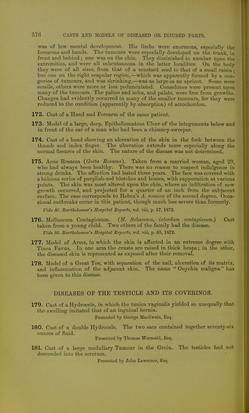 was of low mental development. His limbs were enormous, especially the foreai'ms and hands. Tlie tumours were especially developed on the trunk, in front and behind ; one was on the chin. They diminished in number upon the extremities, and were all subcutaneous in the latter localities. On the body they were of all sizes, from that of a mustard seed to that of a small raisin; but one on the right scapular region,—which was apparently formed by a con- geries of tumours, and was shrinking,—was as large as an apricot. Some were sessile, others were more or less pedunculated. Comedones were present upon many of the tumours. The palms and soles, and palate, were free from growths. Changes had evidently occurred in many of the smaller tumours, for they were reduced to the condition (apparently by absorption) of acrochordon. 172. Cast of a Hand and Forearm of the same patient. 173. Model of a large, deep, Epitheliomatous Ulcer of the integuments below and in front of the ear of a man who had been a chimney-sweeper. 174. Cast of a hand showing an ulceration of the skin in the fork between the thumb and index finger. The ulceration extends more especially along the normal fissures of the skin. The nature of the disease was not determined. 175. Acne Rosacea (Crutta Hosacea). Taken from a married woman, aged 29, who had always been healthy. There was no reason to suspect indulgence in strong drinks. The affection had lasted three years. The face was covered with a hideous series of purplish-red blotches and bosses, with suppuration at various points. The skin was most altered upon the chin, where an infiltration of new growth occurred, and projected for a quarter of an inch from the subjacent surface. The case corresponds to Hebra's A. rosacea of the second degree. Occa- sional outbreaks occur in this patient, though much less severe than formerly. Vide St. Sartholomeio's Hospital Reports, vol. viii, p. 57, 1872. 176. Molluscum Contagiosum. {M. Sebaceum, interdum contagiosujn.) Cast taken from a young child. Two others of the family had the disease. Vide St. Bartholomew's Hospital Reports, vol. viii, p. 65, 1872. 177. Model of Arms, in which the skin is affected in an extreme degree with Tinea Favus. In one arm the crusts are raised in thick heaps; in the other, the diseased skin is represented as exposed after their removal. 178. Model of a Great Toe, with separation of the nail, ulceration of its matrix, and inflammation of the adjacent skin. The name Onychia maligna has been given to this disease. DISEASES OF THE TESTICLE AND ITS COVERINGS. 179. Cast of a Hydrocele, in which the tunica vaginalis yielded so unequally that the swelling imitated that of an inguinal hernia. Presented by George Macilwain, Esq. 180. Cast of a double Hydrocele, The two sacs contained together seventy-six ounces of fluid. Presented by Thomas Wonuald, Esq, 181. Cast of a large medullary Tumour in the Groin. The testicles had not descended into the scrotum. Presented by John Lawrence, Esq.