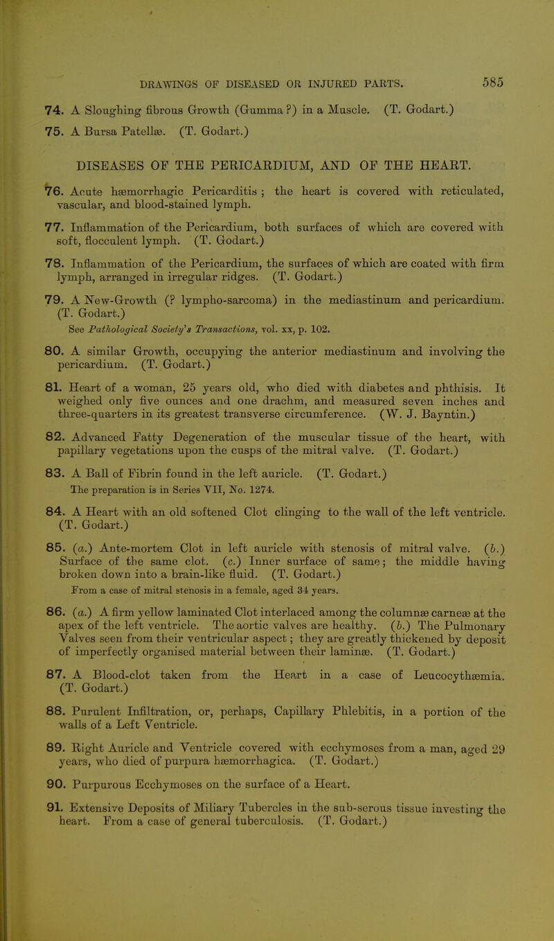 74. A Sloughing fibrous Growth (Gumma ?) in a Muscle. (T. Godart.) 75. A Bursa Patellte. (T. Godart.) DISEASES OF THE PERICARDIUM, AND OF THE HEART. 76. Acute hsemorrhagic Pericarditis ; the heart is covered with reticulated, vascular, and blood-stained lymph. 77. Inflammation of the Pericardium, both surfaces of which are covered with soft, flocculent lymph. (T. Godart.) 78. Inflammation of the Pericardium, the surfaces of which are coated with firm lymph, arranged in irregular ridges. (T. Godart.) 79. A New-Growth (? lympho-sarcoma) in the mediastinum and pericardium. (T. Godart.) See Pathological Society^s Transactions, toI. xx, p. 102. 80. A similar Growth, occupying the anterior mediastinum and involving the pericardium. (T. Godart.) 81. Heart of a woman, 25 years old, who died with diabetes and phthisis. It weighed only five ounces and one drachm, and measured seven inches and three-quarters in its greatest transverse circumference. (W. J. Bayntin.) 82. Advanced Fatty Degeneration of the muscular tissue of the heart, with papillary vegetations upon the cusps of the mitral valve. (T. Godart.) 83. A Ball of Fibrin found in the left auricle. (T. Godart.) The preparation is in Series VII, No. 1274. 84. A Heart with an old softened Clot clinging to the wall of the left ventricle. (T. Godart.) 85. (a.) Ante-mortem Clot in left auricle with stenosis of mitral valve. (&.) Surface of the same clot, (c.) Inner surface of same; the middle having broken down into a brain-like fluid, (T. Godart.) From a case of mitral stenosis in a female, aged 34 years. 86. (a.) A firm yellow laminated Clot interlaced among the columnae carneas at the apex of the left ventricle. The aortic valves are healthy, (h.) The Pulmonary Valves seen from their ventricular aspect; they are greatly thickened by deposit of imperfectly organised material between their laminas. (T. Godart.) 87. A Blood-clot taken from the Heart in a case of Leucocytheemia. (T. Godart.) 88. Purulent Infiltration, or, perhaps. Capillary Phlebitis, in a portion of the walls of a Left Ventricle. 89. Right Auricle and Ventricle covered with ecchymoses from a man, aged 29 years, who died of purpura hcemorrhagica. (T. Godart.) 90. Purpurous Ecchymoses on the surface of a Heart. 91. Extensive Deposits of Miliaiy Tubercles in the sub-serous tissue investing the heart. From a case of general tuberculosis. (T. Godart.)