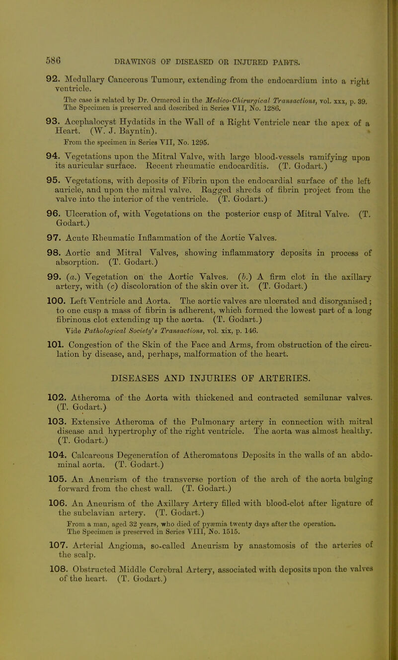 92. Medullary Cancerous Tumour, extending from the endocardium into a right ventricle. The case is related by Dr. Ormerod in tlie Medico-Chirurgical Transactions, vol. xxx, p. 39. The Specimen is preserved and described in Series VII, No. 1286. 93. Acephalocyst Hydatids in the Wall of a Right Ventricle near the apex of a Heart, (W. J. Bayntin). » From the specimen in Series VII, No. 1295. 94. Vegetations upon the Mitral Valve, with large blood-vessels ramifying upon its auricular surface. Recent rheumatic endocarditis. (T. Godart.) 95. Vegetations, with deposits of Fibrin upon the endocardial surface of the left auricle, and upon the mitral valve. Ragged shreds of fibrin project from the valve into the interior of the ventricle. (T. Godart.) 96. Ulceration of, with Vegetations on the posterior cusp of Mitral Valve. (T. Godart.) 97. Acute Rheumatic Inflammation of the Aortic Valves. 98. Aortic and Mitral Valves, showing inflammatory deposits in process of absorption. (T. Godart.) 99. (a.) Vegetation on the Aortic Valves, (h.) A firm clot in the axillary artery, with (c) discoloration of the skin over it. (T. Godart.) 100. Left Ventricle and Aorta. The aortic valves are ulcerated and disorganised; to one cusp a mass of fibrin is adherent, which formed the lowest part of a long fibrinous clot extending up the aorta. (T. Godart.) Vide 'Pathological Society's Transactions, vol. xix, p. 146. 101. Congestion of the Skin of the Face and Arms, from obstruction of the circu- lation by disease, and, perhaps, malfoi^mation of the heart. DISEASES AND INJURIES OF ARTERIES. 102. Atheroma of the Aorta with thickened and contracted semilunar valves. (T. Godart.) 103. Extensive Atheroma of the Pulmonary artery in connection with mitral disease and hypertrophy of the right ventricle. The aorta was almost healthy. (T. Godart.) 104. Calcareous Degeneration of Atheromatous Deposits in the walls of an abdo- minal aorta. (T. Godart.) 105. An Aneurism of the transverse portion of the arch of the aorta bulging forward from the chest wall. (T. Godart.) 106. An Aneurism of the Axillary Artery filled with blood-clot after ligature of the subclavian artery. (T. Godart.) From a man, aged 32 years, who died of pyaemia twenty days after the operation. The Specimen is preserved in Series VIII, No. 1515. 107. Arterial Angioma, so-called Aneurism by anastomosis of the arteries of the scalp. 108. Obstructed Middle Cerebral Artery, associated with deposits upon the valves of the heart. (T. Godart.)