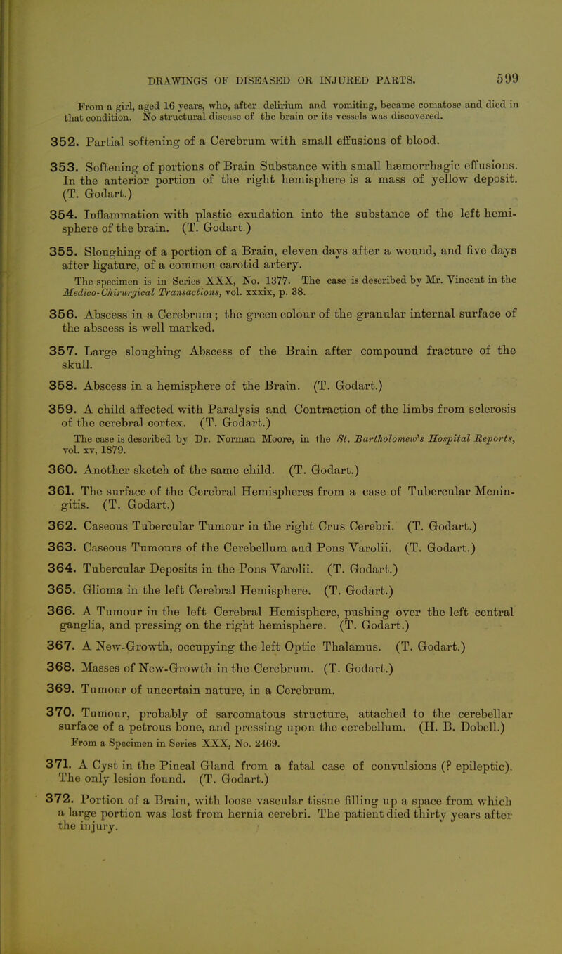 From a girl, aged 16 years, who, after delirium and vomiting, became comatose and died in that condition. No structui'al disease of the brain or its vessels was discovered. 352. Partial softening of a Cerebrum with small effusions of blood. 353. Softening of portions of Brain Substance with small htemorrhagic effusions. In the anterior portion of the right hemisphere is a mass of yellow deposit. (T. Godart.) 354. Inflammation with plastic exudation into the substance of the left hemi- sphere of the brain. (T. Godart.) 355. Sloughing of a portion of a Brain, eleven days after a wound, and five days after ligature, of a common carotid artery. The specimen is in Series XXX, No. 1377. The case is described by Mr. Vincent in the Medico-Chirurgical Transactions, vol. xxxix, p. 38. 356. Abscess in a Cerebrum; the green colour of the granular internal surface of the abscess is well marked. 357. Large sloughing Abscess of the Brain after compound fracture of the skull. 358. Abscess in a hemisphere of the Brain. (T. Godart.) 359. A child affected with Paralysis and Contraction of the limbs from sclerosis of the cerebral cortex. (T. Godart.) The case is described by Dr. Norman Moore, in the /%. Bartholomeiv's Hospital Reports, vol. XV, 1879. 360. Another sketch of the same child. (T. Godart.) 361. The surface of the Cerebral Hemispheres from a case of Tubercular Menin- gitis. (T. Godart.) 362. Caseous Tubercular Tumour in the right Crus Cerebri. (T. Godart.) 363. Caseous Tumours of the Cerebellum and Pons Varolii. (T. Godart.) 364. Tubercular Deposits in the Pons Varolii. (T. Godart.) 365. Glioma in the left Cerebral Hemisphere. (T. Godart.) 366. A Tumour in the left Cerebral Hemisphere, pushing over the left central ganglia, and pressing on the right hemisphere. (T. Godart.) 367. A New-Growth, occupying the left Optic Thalamus. (T. Godart.) 368. Masses of New-Growth in the Cerebrum. (T. Godart.) 369. Tumour of uncertain nature, in a Cerebrum. 370. Tuniour, probably of sarcomatous structure, attached to the cerebellar surface of a petrous bone, and pressing upon the cerebellum. (H. B. Dobell.) From a Specimen in Series XXX, No. 2469. 371. A Cyst in the Pineal Gland from a fatal case of convulsions (? epileptic). The only lesion found. (T. Godart.) 372. Portion of a Brain, with loose vascular tissue filling up a space from which a large portion was lost from hernia cerebri. The patient died thirty years after the injury.