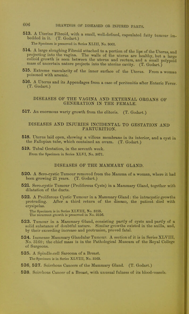 513. A Uterine Fibroid, with a small, well-defined, capsulated fatty tumour im. bedded in it. (T. Godart.) ^ The Specimen is preserved in Series XLIII, No. 3001, 514. A large sloughing Fibroid attached to a portion of the lips of the Uterus, and projecting into the vagina. The walls of the uterus are healthy, but a large colloid growth is seen between the uterus and rectum, and a small polypoid mass of uncertain nature projects into the uterine cavity. (T. Godart.) 515. Extreme vascularity of the inner surface of the Uterus. From a woman poisoned with arsenic. 516. A Uterus and its Appendages from a case of peritonitis after Enteric Fever (T. Godart.) DISEASES OP THE VAGINA AND EXTERNAL ORGANS OF GENERATION IN THE FEMALE. 517. An enormous warty growth from the clitoris. (T. Godart.) DISEASES AND INJURIES INCIDENTAL TO GESTATION AND PARTURITION. 518. Uterus laid open, showing a villous membrane in its interior, and a cyst iu the Fallopian tube, which contained an ovum. (T. Godart.) 519. Tubal Gestation, in the seventh week. From the Specimen in Series XLVI, No. 3071. DISEASES OF THE MAMMARY GLAND. 520. A Sero-cystic Tumour removed from the Mamma of a woman, where it had been growing 21 years. (T. Godart.) 521. Sero-cystic Tumour (Proliferous Cysts) in a Mammary Gland, together with dilatation of the ducts. 522. A Proliferous Cystic Tumour in a Mammary Gland: the intracystic growths protruding. After a third return of the disease, the patient died with erysipelas. The Specimen is in Series XLVIII, No. 3155. The recurrent growth is preserved in No. 3156. 523. Tumour in a Mammary Gland, consisting partly of cysts and partly of a solid substance of doubtful nature. Similar growths existed in the axilla, and, by their exceeding increase and protrusion, proved fatal. 524. Immense Mammary Glandular Tumour. A section of it is in Series XLYIII, No. 31G0; the chief mass is in the Pathological Museum of the Royal College of Surgeons. 525. A Spindle-cell Sarcoma of a Breast. The Specimen is in Series XLVIII, No. 3163. 526. 527. Scirrhous Cancers of the Mammary Gland. (T. Godart.) 528, Scirrhous Cancer of a Breast, with unusual fulness of its blood-vessels.