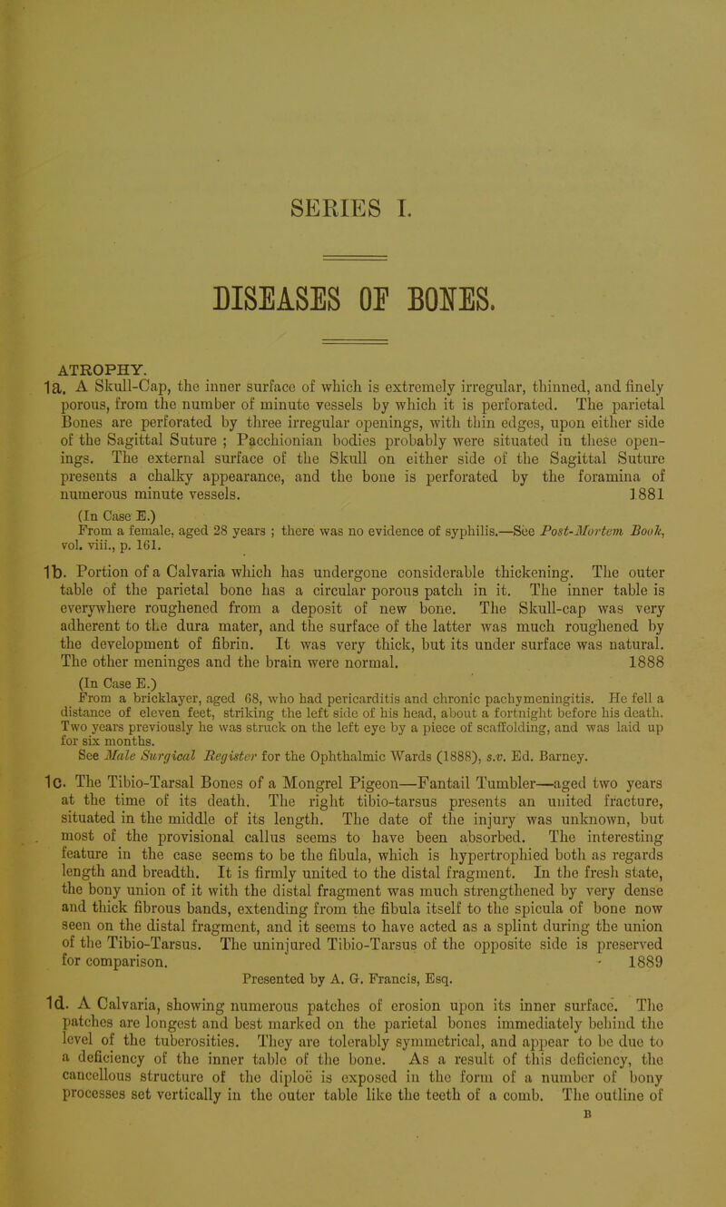 DISEASES OE BOIES. ATROPHY. 1a. A Skull-Cap, the inner surface of which is extremely irregular, thinned, and finely porous, from the number of minute vessels by which it is perforated. The parietal Bones are perforated by three irregular openings, with thin edges, upon either side of the Sagittal Suture ; Pacchionian bodies probably were situated in these open- ings. The external surface of the Skull on either side of the Sagittal Suture presents a chalky appearance, and the bone is perforated by the foramina of numerous minute vessels. ] 881 (In Case E.) From a female, aged 28 years ; there was no evidence of syphilis.—See Post-Mortcvi Book, vol. viii., p. 161. lb. Portion of a Calvaria which has undergone considerable thickening. The outer table of the parietal bone has a circular porous patch in it. The inner table is everywhere roughened from a deposit of new bone. The Skull-cap was very adherent to the dura mater, and the surface of the latter was much roughened by the development of ifibrin. It was very thick, but its under surface was natural. The other meninges and the brain were normal. 1888 (In Case E.) From a bricklayer, aged G8, who had pericarditis and chronic pachymeningitis. He fell a distance of eleven feet, striking the left side of his head, about a fortnight before his death. Two years previously he was struck on the left eye by a piece of scaffolding, and was laid up for six months. See Male Surgical Register for the Ophthalmic Wards (1888), s.v. Ed. Barney. 1c. The Tibio-Tarsal Bones of a Mongrel Pigeon—Fantail Tumbler—aged two years at the time of its death. The right tibio-tarsus presents an united fracture, situated in the middle of its length. The date of the injury was unknown, but most of the provisional callus seems to have been absorbed. The interesting feature in the case seems to be the fibula, which is hypertrophied both as regards length and breadth. It is firmly united to the distal fragment. In the fresh state, the bony union of it with the distal fragment was much strengthened by very dense and thick fibrous bands, extending from the fibula itself to the spicula of bone now seen on the distal fragment, and it seems to have acted as a splint during the union of the Tibio-Tarsus. The uninjured Tibio-Tarsus of the opposite side is preserved for comparison. - 1889 Presented by A. G. Francis, Esq. Id. A Calvaria, showing numerous patches of erosion upon its inner surface. The patches are longest and best marked on the parietal bones immediately behind the level of the tuberosities. They are tolerably symmetrical, and appear to be due to a deficiency of the inner table of the bone. As a result of this deficiency, the cancellous structure of the diploe is exposed in the form of a number of bony processes set vertically in the outer table like the teeth of a comb. The outline of B