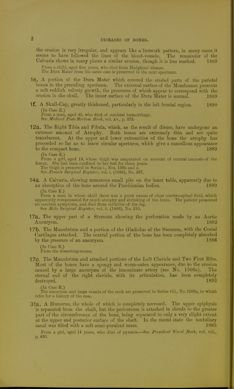 the erosion is very irregular, and aijpears like a fretwork pattern, in many cases it seems to have followed the lines of the blood-vessels. The remainder of the Calvaria shows in many places a similar erosion, though it is less marked, 1889 From a child, aged five years, who died from HodgkiiiK' disease. The Dura Mater i'rom the same case is preserved in the next specimen. 1e. A portion of the Dura Mater which covered the eroded parts of the parietal bones in the preceding specimen. The external surface of the Meml)ranes presents a soft reddish velvety growth, the processes of which appear to correspond with the erosion in the skull. The inner surface of the Dura Mater is normal. 1889 If. A Skull-Cap, greatly thickened, particularly in the left frontal region. 1890 (In Case E.) From a man, aged 45, who died of cerebral heemorrhage. See .Medical Post-Mortem JBooh, vol, xv., p. 373. 12a. The Right Tibia and Fibula, which, as the result of disuse, have undergone an extreme amount of Atrophy, Both bones are extremely thin and are quite • translucent. At the upper and lower extremities of the bone the atropliy has proceeded so far as to leave circular apertures, which give a cancellous appearance to the compact bone. 1889 (In Case E.) From a girl, aged 13, whose thigh was amputated on account of central necrosis of the femur. She had been confined to her bed for three years. The thigh is preserved in Series i., Nos. 138b and c. See Female Surgical Register, vol. i. (1889), No, 367. 14a. A Calvaria, showing numerous small pits on the inner table, apparently due to an absorption of the bone around the Paccliionian bodies. 1889 (In Case E,) From a man in whose skull there was a great excess of clear cerebro-spinal fluid, which apparently compensated for much atrophy and shrinking of the brain. The patient presented no cerebral symptoms, and died from cellulitis of the leg. See Male Sitrgical Register, vol. ii, (1889), No, 210. 17a. The upper part of a Sternum showing the perforation made by an Aortic Aneurysm. 1882 17b. The Manubrium and a portion of the Gladiolus of the Sternum, with the Costal Cartilages attached. The central portion of the bone has been completely absorbed by the pressure of an aneurysm. 1886 (In Case E.) From the dissecting-rooms. 17c, The Manubrium and attached portions of the Left Clavicle and Two First Eibs. Most of the bones have a spongy and worm-eaten appearance, due to the erosion caused by a large aneurysm of the innominate artery (see No. 1506a), The sternal end of the right clavicle, with its articulation, has been completely destroyed. 1893 (In Case E,) The aneurysm and large vessels of the neck are preserved in Series viii,, No, 1506a, to wliich refer for a history of the case, 31a. A Humerus, the whole of which is completely necrosed. The upper cpipliysis is separated from the shaft, but the periosteum is attached in shreds to tlie greater part of the circumference of the bone, being separated to only a very slight extent at the upper and posterior surface of the shaft. In the recent state the medullary canal was filled with a soft semi-purulent mass. 1883 From a girl, aged 14 years, who ilicd of pya;mia,—Sec President Ward Booh, vol, viii., p, 430.