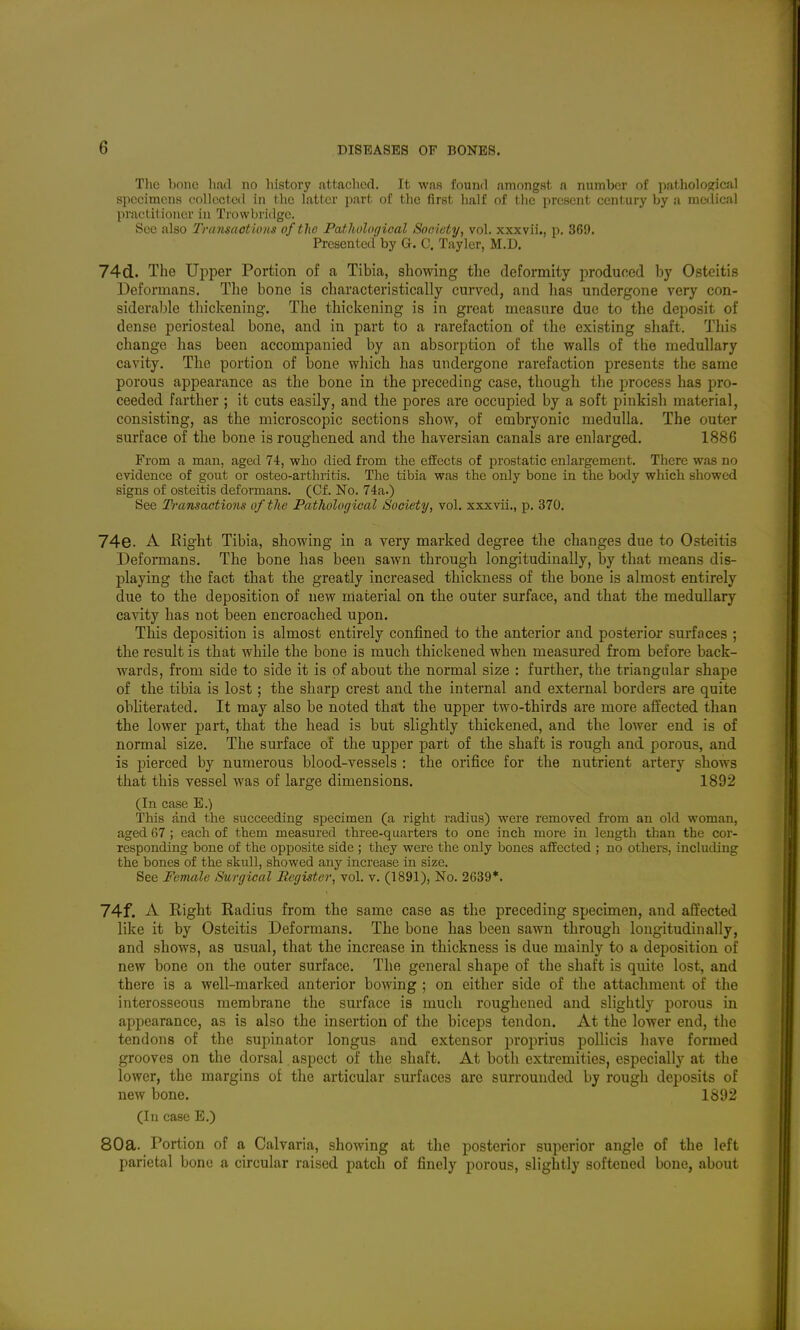 The bone had no history attached. It was found amongst a number of pathological specimens collected in the latter part of the first half of the present century by a medical practitioner in Trowbridge. See also Transaotions of the Pathologioal Society, vol. xxxvii., p. 369. Presented by G. C. Tayler, M.D. 74d.. The Upper Portion of a Tibia, showing the deformity produced by Osteitis Deformans. The bone is characteristically cm*yed, and lias undergone very con- siderable thickening. The thickening is in great measure due to the deposit of dense periosteal bone, and in part to a rarefaction of the existing shaft. This change has been accompanied by an absorption of the walls of the medullary cavity. The portion of bone which has undergone rarefaction presents the same porous appearance as the bone in the preceding case, though the process has pro- ceeded farther ; it cuts easily, and the pores are occupied by a soft pinkish material, consisting, as the microscopic sections show, of embryonic medulla. The outer surface of the bone is roughened and the haversian canals are enlarged. 1886 From a man, aged 74, who died from the effects of prostatic enlargement. There was no evidence of gout or osteo-arthritis. The tibia was the only bone in the body which showed signs of osteitis deformans. (Cf. No. 74a.) See Transactions of the Pathological Society, vol. xxxvii., p. 370. 74e. A Right Tibia, showing in a very marked degree the changes due to Osteitis Deformans. The bone has been sawn through longitudinally, by that means dis- playing the fact that the greatly increased thickness of the bone is almost entirely due to the deposition of new material on the outer surface, and that the medullary cavity has not been encroached upon. This deposition is almost entirely confined to the anterior and posterior surfaces ; the result is that while the bone is much thickened when measured from before back- wards, from side to side it is of about the normal size : further, the triangular shape of the tibia is lost; the sharp crest and the internal and external borders are quite obliterated. It may also be noted that the upper two-thirds are more affected than the lower part, that the head is but slightly thickened, and the lower end is of normal size. The surface of the upper part of the shaft is rough and porous, and is pierced by numerous blood-vessels : the orifice for the nutrient artery shows that this vessel was of large dimensions. 1892 (In case E.) This and the succeeding specimen (a right radius) were removed from an old woman, aged 67 ; each of them measured three-quarters to one inch more in length than the cor- responding bone of the opposite side ; they were the only bones affected ; no others, including the bones of the skull, showed any increase in size. See Female Surgical Register, vol. v. (1891), No. 2639*. 74f. A Right Radius from the same case as the preceding specimen, and affected like it by Osteitis Deformans. The bone has been sawn through longitudinally, and shows, as usual, that the increase in thickness is due mainly to a deposition of new bone on the outer surface. The general shape of the shaft is quite lost, and there is a well-marked anterior bowing ; on either side of the attachment of the interosseous membrane the surface is much roughened and slightly porous in appearance, as is also the insertion of the biceps tendon. At the lower end, the tendons of the supinator longus and extensor proprius pollicis have formed grooves on the dorsal aspect of the shaft. At both extremities, especially at the lower, the margins of the articular surfaces are surrounded by rough deposits of new bone. 1892 (In case E.) 80a. Portion of a Calvaria, showing at the posterior superior angle of the left parietal bone a circular raised patch of finely porous, slightly softened bone, about