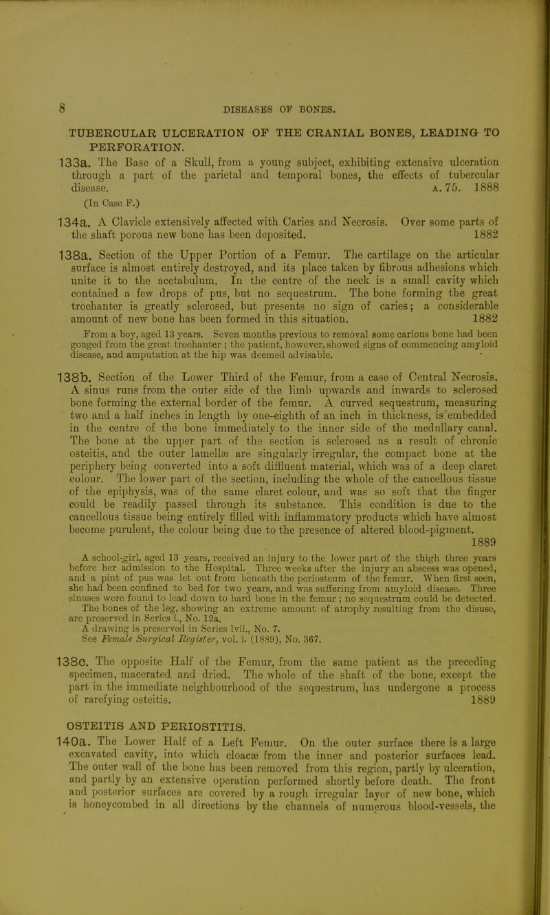TUBERCULAR ULCERATION OF THE CRANIAL BONES, LEADING TO PERFORATION. 133a. The Base of a Skull, from a young subject, exhibiting extensive ulceration through a part of the parietal and temporal bones, the effects of tubercular disease. a. 75. 1888 (In Case F.) 134a. A Clavicle extensively affected with Caries and Necrosis. Over some parts of the shaft porous new bone has been deposited. 1882 138a. Section of the Upper Portion of a Femur. The cartilage on the articular surface is almost entirely destroyed, and its place taken by fibrous adhesions which unite it to the acetabulum. In the centre of the neck is a small cavity which contained a few drops of pus, but no sequestrum. The bone forming the great trochanter is greatly sclerosed, but presents no sign of caries; a considerable amount of new bone has been formed in this situation. 1882 From a boy, aged 13 years. Seven months previous to removal some carious bone had been gouged from the great trochanter ; the patient, however, showed signs of commencing amyloid disease, and amputation at the hip was deemed advisable. 138b. Section of the Lower Third of the Femur, from a case of Central Necrosis. A sinus runs from the outer side of the limb upwards and inwards to sclerosed bone forming the external border of the femur. A curved sequestrum, measuring two and a half inches in length by one-eighth of an inch in thickness, is'embedded in the centre of the bone immediately to the inner side of the medullary canal. The bone at the upper part of the section is sclerosed as a result of chronic osteitis, and the outer lamellas are singularly irregular, the compact bone at the periphery being converted into a soft diffluent material, which was of a deep claret colour. The lower part of the section, including the whole of the cancellous tissue of the epiphysis, was of the same claret colour, and was so soft that the finger could be readily passed through its substance. This condition is due to the cancellous tissue being entirely filled with inflammatory products which have almost become purulent, the colour being due to the presence of altered blood-pigment. 1889 A school-^irl, aged 13 years, received an injury to the lower part of the thigh three years before her admission to the Hospital. Tliree weeks after the injury an abscess was opened, and a pint of pus was let out from beneath the periosteum of the femur. When first seen, she had been confined to bed for two years, and was suffering from amyloid disease. Three sinuses were found to lead down to hard bone in the femur ; no sequestrum could be detected. The bones of the leg, showing an extreme amount of atrophy resulting from the disuse, are preserved in Series i., No. 12a. ' A drawing is preserved in Series Ivii., No. 7. See Female Surgical Register, vol. i. (1889), No. 367. 138c. The opposite Half of the Femm', from the same patient as the preceding specimen, macerated and dried. The whole of the shaft of the bone, except the part in the immediate neighbourhood of the sequestrum, has undergone a process of rarefying osteitis. 1889 OSTEITIS AND PERIOSTITIS. 140a. The Lower Half of a Left Femur, On the outer surface there is a large excavated cavity, into which cloacse from the inner and posterior surfaces lead. The outer wall of the bone has been removed from this region, partly by ulceration, and partly by an extensive operation performed shortly before death. The front and posterior surfaces are covered by a rough irregular layer of new bone, which is honeycombed in all directions by the channels of numerous blood-vessels, the