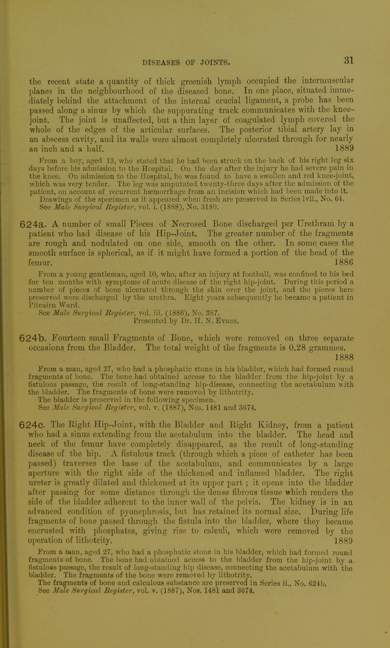 the recent state a quantity of thick gi-eenish lymph occupied the intermuscular planes in the neighbourhood of the diseased bone. In one place, situated imme- diately behind the attachment of the internal crucial ligament, a probe has been passed along a sinus by which the suppurating track communicates with the knee- joint. The joint is unaffected, but a thin layer of coagulated lymph covered the whole of the edges of the articular surfaces. The posterior tibial artery lay in an abscess cavity, and its walls were almost completely ulcerated through for nearly an inch and a half. 1889 From a boy, aged 13, who stated that he had been struck on the back of his right log six days before his admission to the Hospital. On the day after the injury he had severe pain in the knee. On admission to the Hospital, he was found to have a swollen and red knee-joint, which was very tender. The leg was amputated twenty-three days after the admission of the patient, on account of recurrent hEemorrhage from an incision which had been made into it. Drawings of the specimen as it appeared when fresh are preserved in Series Ivii., No. 64. See Male Surgical Register, vol. i. (1888), No. 3180. 624a. A number of small Pieces of Necrosed Bone discharged per Urethrani by a patient who had disease of his Hip-Joint. The greater number of the fragments are rough and nodulated on one side, smooth on the other. In some cases the smooth surface is spherical, as if it might have formed a portion of the head of the femur. 1886 From a young gentleman, aged 10, who, after an injury at football, was confined to his bed for ten months with symptoms of acute disease of the right hip-joint. During this period a number of pieces of bone ulcerated through the skin over the joint, and the pieces here preserved were discharged by the urethra. Eight years subsequently he became a patient in Pitcairn Ward. See Male Surgical Register, vol. iii. (1886), No. 387. Presented by Dr. H. N. Evans. 6241b. Fourteen small Fragments of Bone, which were removed on three separate occasions from the Bladder. The total weight of the fragments is 0.28 grammes. 1888 From a man, aged 27, who had a phosphatic stone in his bladder, which had formed round fragments of bone. The bone had obtained access to the bladder from the hip-joint by a fistulous passage, the result of long-standing hip-disease, connecting the acetabulum with the bladder. The fragments of bone were removed by lithotrity. The bladder is preserved in the following specimen. See Male Surgical Register, vol. v. (1887), Nos. 1481 and 3674. 624c. The Right Hip-Joint, with the Bladder and Right Kidney, from a patient who had a sinus extending from the acetabulum into the bladder. The head and neck of the femur have completely disappeared, as the result of long-standing disease of the hip. A fistulous track (through which a piece of catheter has been passed) traverses the base of the acetabulum, and communicates by a large aperture with the right side of the thickened and inflamed bladder. The right ureter is greatly dilated and thickened at its upper part ; it opens into the bladder after passing for some distance througb the dense fibrous tissue which renders the side of the bladder adherent to the inner wall of the pelvis. The kidney is in an advanced condition of pyonephrosis, but has retained its normal size. During life fragments of bone passed through the fistula into the bladder, where they became encrusted with phosphates, giving rise to calculi, which were removed by the operation of lithotrity. 1889 From a man, aged 27, who had a phosphatic stone in his bladder, which had formed round fragments of bone. The bone had obtained access to the bladder from the hip-joint by a fistulous passage, the result of long-standing hip disease, connecting the acetabulum with the bladder. The fragments of the bone were removed by lithotrity. The fragments of bone and calculous substance are preserved in Scries ii., No. 624b. See Male Surgical Register, vol. v. (1887), Nos. 1481 and 3674.