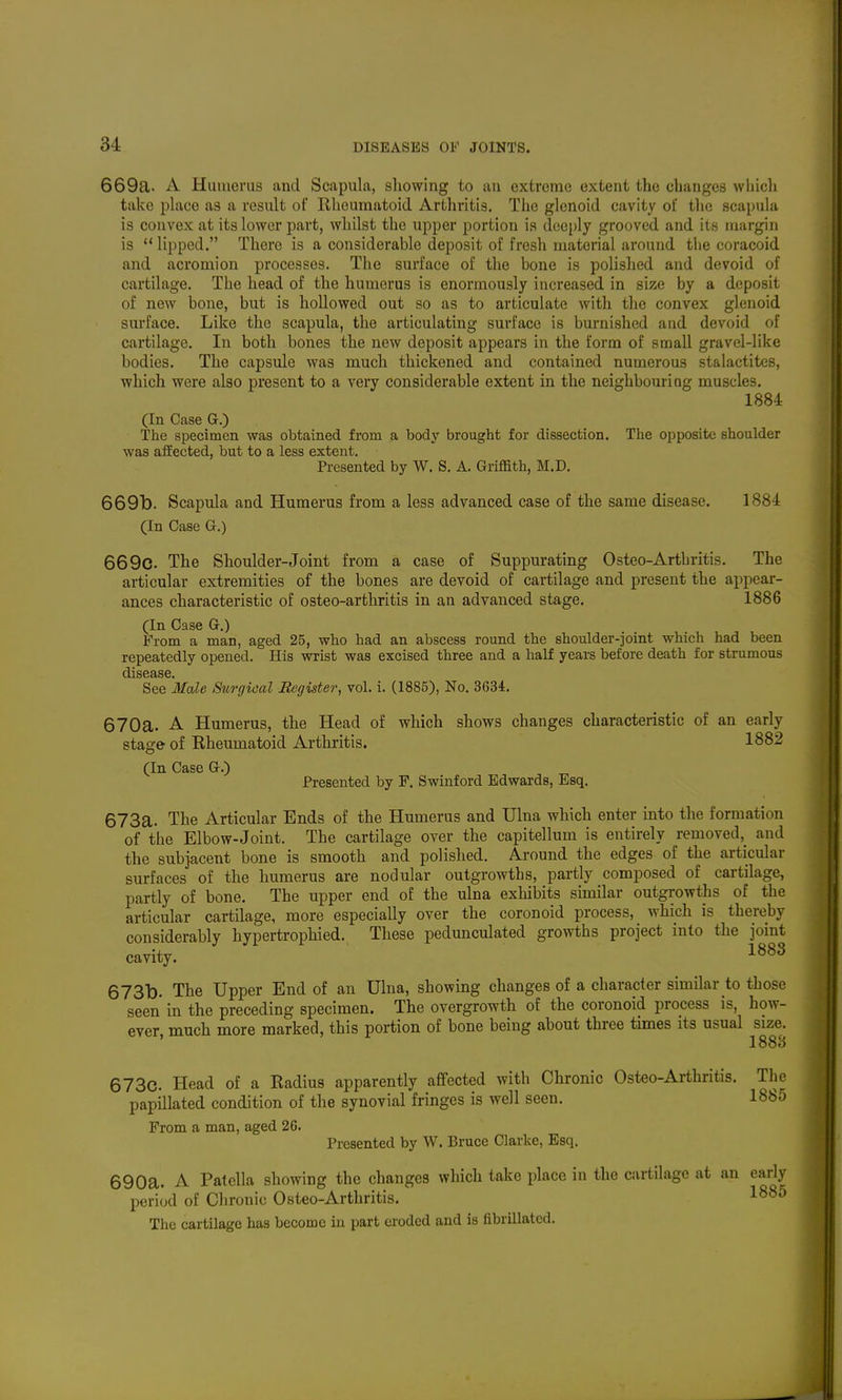 669a. A Humerus and Scapula, sliowing to an extreme extent the changes wliicli take place as a result of Rheumatoid Artliritis, Tlie glenoid cavity of tlie scapula is convex at its lower part, whilst the upper portion is deeply grooved and its margin is  lipped. There is a considerable deposit of fresh material around the coracoid and acromion processes. The surface of the bone is polished and devoid of cartilage. The head of the humerus is enormously increased in size by a deposit of new bone, but is hollowed out so as to articulate with the convex glenoid surface. Like the scapula, the articulating surface is burnished and devoid of cartilage. In both bones the new deposit appears in the form of small gravel-like bodies. The capsule was much thickened and contained numerous stalactites, which were also present to a very considerable extent in the neighbouring muscles. 1884 (In Case G.) The specimen was obtained from a body brought for dissection. The opposite shoulder was affected, but to a less extent. Presented by W. S. A. Griffith, M.D. 669b. Scapula and Humerus from a less advanced case of the same disease. 1884 (In Case G.) 669c. The Shoulder-Joint from a case of Suppurating Osteo-Arthritis. The articular extremities of the bones are devoid of cartilage and present the appear- ances characteristic of osteo-arthritis in an advanced stage. 1886 (In Case G.) From a man, aged 25, who had an abscess round the shoulder-joint which had been repeatedly opened. His wrist was excised three and a half years before death for strumous disease. See Male Sm'ffical Register, vol. i. (1885), No. 3634. 670a. A Humerus, the Head of which shows changes characteristic of an early stage of Rheumatoid Arthritis. 1882 (In Case G.) Presented by F. Swinford Edwards, Esq. 673a. The Articular Ends of the Humerus and Ulna which enter into the formation of the Elbow-Joint. The cartilage over the capitellum is entirely removed,^ and the subjacent bone is smooth and polished. Around the edges of the articular surfaces of the humerus are nodular outgrowths, partly composed of cartilage, partly of bone. The upper end of the ulna exhibits similar outgrowths of the articular cartilage, more especially over the coronoid process, which is thereby considerably hypertrophied. These pedunculated growths project into the joint cavity. ^^^^ 673b. The Upper End of an Ulna, showing changes of a character similar to those seen in the preceding specimen. The overgrowth of the coronoid process is, how- ever, much more marked, this portion of bone being about three times its usual size. 1883 673c. Head of a Radius apparently aflfected with Chronic Osteo-Arthritis. The papillated condition of the synovial fringes is well seen. 1885 From a man, aged 26. Presented by W. Bruce Clarke, Esq. 690a. A Patella showing the changes which take place in the cartilage at an early period of Chronic Osteo-Arthritis. 1885 The cartilage has become in part eroded and is fibrillated.