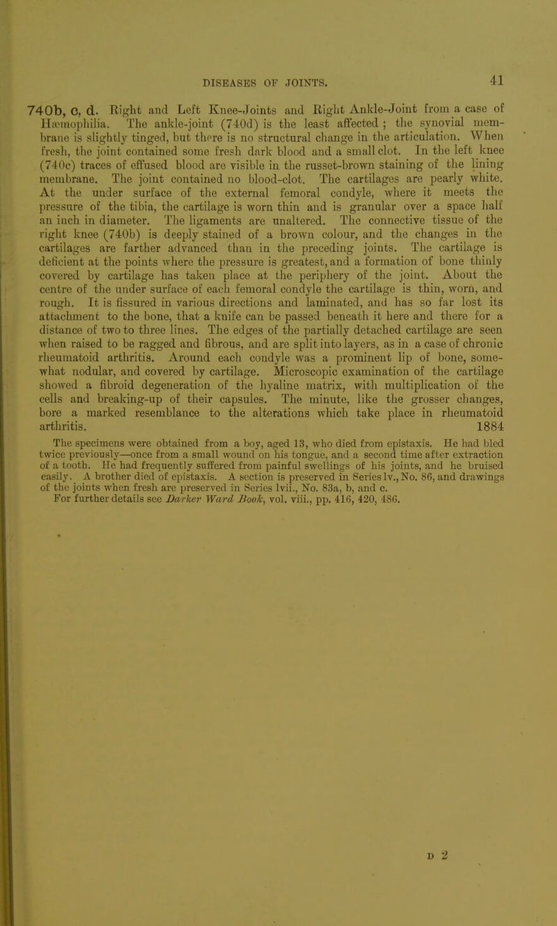 740b, C, d. Right and Left Knee-Joints and Right Ankle-Joint from a case of HaMnopliiha. The ankle-joint (740d) is the least affected ; the synovial mem- brane is slightly tinged, but there is no structural change in the articulation. When fresh, the joint contained some fresh dark blood and a small clot. In the left knee (740c) traces of effused blood are visible in the russet-brown staining of the lining membrane. The joint contained no blood-clot. The cartilages are pearly white. At the under surface of the external femoral condyle, where it meets the pressure of the tibia, the cartilage is worn thin and is granular over a space half an inch in diameter. The ligaments are unaltered. The connective tissue of the right knee (740b) is deeply stained of a brown colour, and the changes in the cartilages are farther advanced than in the preceding joints. The cartilage is deficient at the points where the pressure is greatest, and a formation of bone thinly covered by cartilage has taken place at the periphery of the joint. About the centre of the under surface of each femoral condyle the cartilage is thin, worn, and rough. It is fissured in various directions and laminated, and has so far lost its attachment to the bone, that a knife can be passed beneath it here and tliere for a distance of two to three lines. The edges of the partially detached cartilage are seen when raised to be ragged and fibrous, and are split into layers, as in a case of chronic rheumatoid arthritis. Around each condyle was a prominent lip of bone, some- what nodular, and covered by cartilage. Microscopic examination of the cartilage showed a fibroid degeneration of the hyaline matrix, with multiplication of the cells and breaking-up of their capsules. The minute, like the grosser changes, bore a marked resemblance to the alterations which take place in rheumatoid arthritis. 1884 The specimens were obtained from a boy, aged 13, who died from epistaxis. He had bled twice previously—once from a small wound on his tongue, and a second time after extraction of a tooth. He had frequently suffered from painful swellings of his joints, and he bruised easily. A brother died of epistaxis. A section is preserved in Series Iv., No. 86, and drawings of the joints when fresh are preserved in Series Ivii., No, 83a, b, and c. For further details see Barher Ward Book, vol. viii., pp. 416, 420, 486. D 2