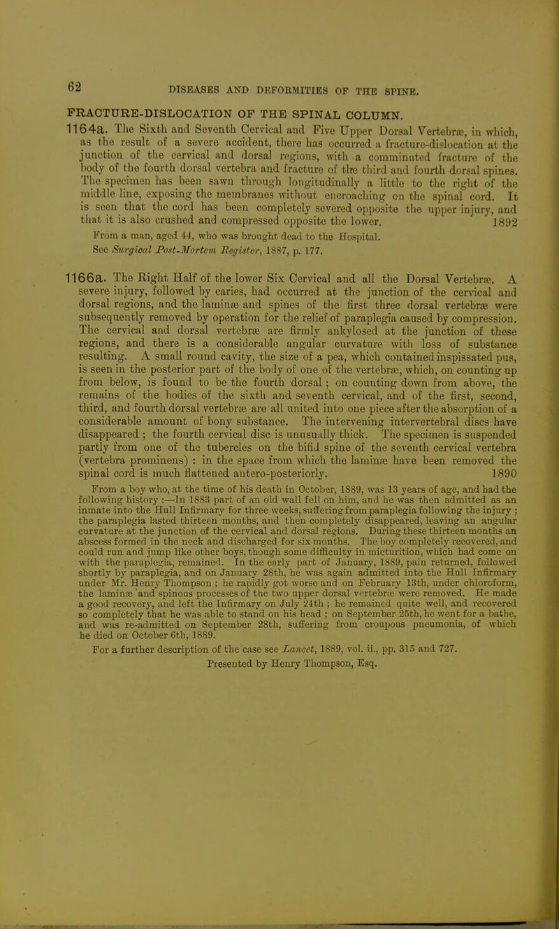 FRACTURE-DISLOCATION OF THE SPINAL COLUMN. 1164a. The Sixth and Sevonth Cervical and Five Upper Dorsal Vertebraj, in which, as the result of a severe accident, there has occurred a fracture-dislocation at the junction of the cervical and dorsal regions, with a comminuted fracture of the body of the fourth dorsal vertebra and fracture of tire third and fourth dorsal spines. The specimen has been sawn through longitudinally a little to the right of the middle line, exposing the membranes without encroaching on the spinal cord. It is seen_ that the cord has been completely severed opposite the upper injury, and that it is also crushed and compressed opposite the lower. 1892 From a man, aged 44, who was brought dead to the Hospital. See Surgical Post.Mortem Register, 1887, p. 177. 1166a. The Right Half of the lower Six Cervical and all the Dorsal Vertebrje. A severe injury, followed by caries, had occurred at the junction of the cervical and dorsal regions, and the laminje and spines of the first three dorsal vertebrae were subsequently removed by operation for the relief of paraplegia caused by compression. The cervical and dorsal vertebraj are firmly ankylosed at the junction of these regions, and there is a considerable angular curvature with loss of substance resulting. A small round cavity, the size of a pea, which contained inspissated pus, is seen in the posterior part of the body of one of the vertebr£e, which, on counting up from below, is found to be the fourth dorsal ; on counting down from above, the remains of the bodies of the sixth and seventh cervical, and of the first, second, third, and fourth dorsal vertebra are all united into one piece after the absorption of a considerable amount of bony substance. The intervening intervertebral discs have disappeared ; the fourth cervical disc is unusually thick. The specimen is suspended partly from one of the tubercles on the bifid spine of the seventh cervical vertebra (vertebra prominens) : in the space from which the laminae have been removed the spinal cord is much flattened antero-posteriorly. 1890 From a boy who, at the time of his death in October, 1889, was 13 years of age, and had the following history :—In 1883 part of an old wall fell on him, and he was then admitted as an inmate into the Hull Infirmary for three weeks, suffering from paraplegia following the injury ; the paraplegia lasted thirteen months, and then completely disappeared, leaving an angular curvature at the junction of the cervical and dorsal regions. During these thirteen months an abscess formed in the neck and discharged for six months. The boy completely recovered, and could run and jump like other boys, though some difficulty in micturition, which had come on with the paraplegia, remained. In the early part of January, 1889, pain returned, followed shortly by paraplegia, and on January 28th, he was again admitted into the Hull Infirmary under Mr. Henry Thompson ; he rapidly got worse and on February 13th, under chloroform, the laminEe 'and spinous processes of the two upper dorsal vortebra3 were removed. He made a good recovery, and left the Infirmary on July 24th ; he remained quite well, and recovered so completely that he was able to stand on his head ; on September 25th, he went for a bathe, and was re-admitted on September 28th, suffering from croupous pneumonia, of which he died on October 6th, 1889. For a further description of the'case see Lancet, 1889, vol. ii., pp. 315 and 727. Presented by Henry Thompson, Esq.