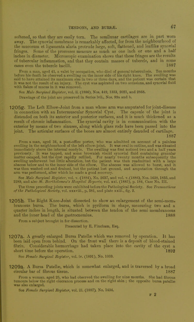 softened, so that tliey are easily torn. The semilunar cartilag'es are in part worn away. The synovial membrane is remarkably affected, for from the neighbourhood of the mneosum et ligamenta alaria protrude large, soft, flattened, and leaflike synovial fringes. Some of the processes measure as much as one inch or one and a half inches in diameter. Microscopic examination shows that these fringes are the results of tubercular inflammation, and that they contain masses of tubercle, and in some cases even the tubercle bacilli. 1887 From a man, aged 41, a valet by occupation, who died of general tuberculosis. Ten months before his death he observed a swelling on the inner side of his right knee. The swelling was said to have attained its maximum size in two or three days, and the patient was certain that it was not the result of an injury. The cyst was aspirated on two occasions, and synovial fluid with flakes of mucus in it was removed. See Male Siirgical Register, vol. ii. (1886), Nos. 449, 1353, 2021, and 2868. Drawings of the joint are preserved in Series Ivii., Nos. 99a and b. 1205g'. The Left Elbow-Joint from a man whose arm was amputated for joint-disease in connection with an Intermuscular Synovial Cyst. The capsule of the joint is distended on both its anterior and posterior surfaces, and it is much thickened as a result of chronic inflammation. The synovial cavity is in communication with the exterior by means of two sinuses, along which glass rods have been passed into the joint. The articular surfaces of the bones are almost entirely denuded of cartilage. 1887 From a man, aged 34, a post-office porter, who was admitted on account of a painless swelling in the neighbourhood of the left elbow-joint. It was oval in outline, and was situated immediately above the internal condyle. The swelling was first noticed two and a half years previously. It was tapped, and some brownish viscid synovial fluid containing granular matter escaped, but the cyst rapidly refilled. For nearly twenty months subsequently the swelling underwent but little alteration, but the patient was then readmitted with a large abscess below and to the inner side of the elbow. The abscess was allowed to burst, and it was then washed out and drained, but the patient lost ground, and amputation through the arm was performed, after which he made a good recovery. See Male Surgical Register, vol. v. (1884), No. 2637, and vol. v. (1886), Nos. 1638,1835, and 2289, and also St. Bartholomew's HosiJital Reports, vol. xxi. (1885), p. 184, Case No. III. The three preceding joints were exhibited before the Pathological Society. See Transactions of the Pathological Society, vol. xxxviii., p. 381, and plate xxiii., fig. 2. 1205ll. The Right Knee-Joint dissected to show an enlargement of the semi-memT branosus bursa. The bursa, which is pyriform in shape, measuring two and a quarter inches in length, is situated between the tendon of the semi membranosus and the inner head of the gastrocnemius. 1888 From a subject brought in for dissection. Presented by E. Fincham, Esq. 1207a. A greatly enlarged Bursa PatellaB which was removed by operation. It has been laid open from behind. On the front wall there is a deposit of blood-stained fibrin. Considerable haemorrhage had taken place into the cavity of the cyst a short time before the operation. 1892 See Female Surgical Register, vol. iv. (1891), No. 1033. 1209a. A Bursa Patellfe, which is somewhat enlarged, and is traversed by a broad circular bar of fibrous tissue. 1887 From a woman, aged 25, who had observed the swelling for nine months. She had fibrous tumours below the right olecranon process and on the right shin ; the opposite bursa patellae was also enlarged. See Female Surgical Register, vol. iil. (1887), No. 1434. F 2