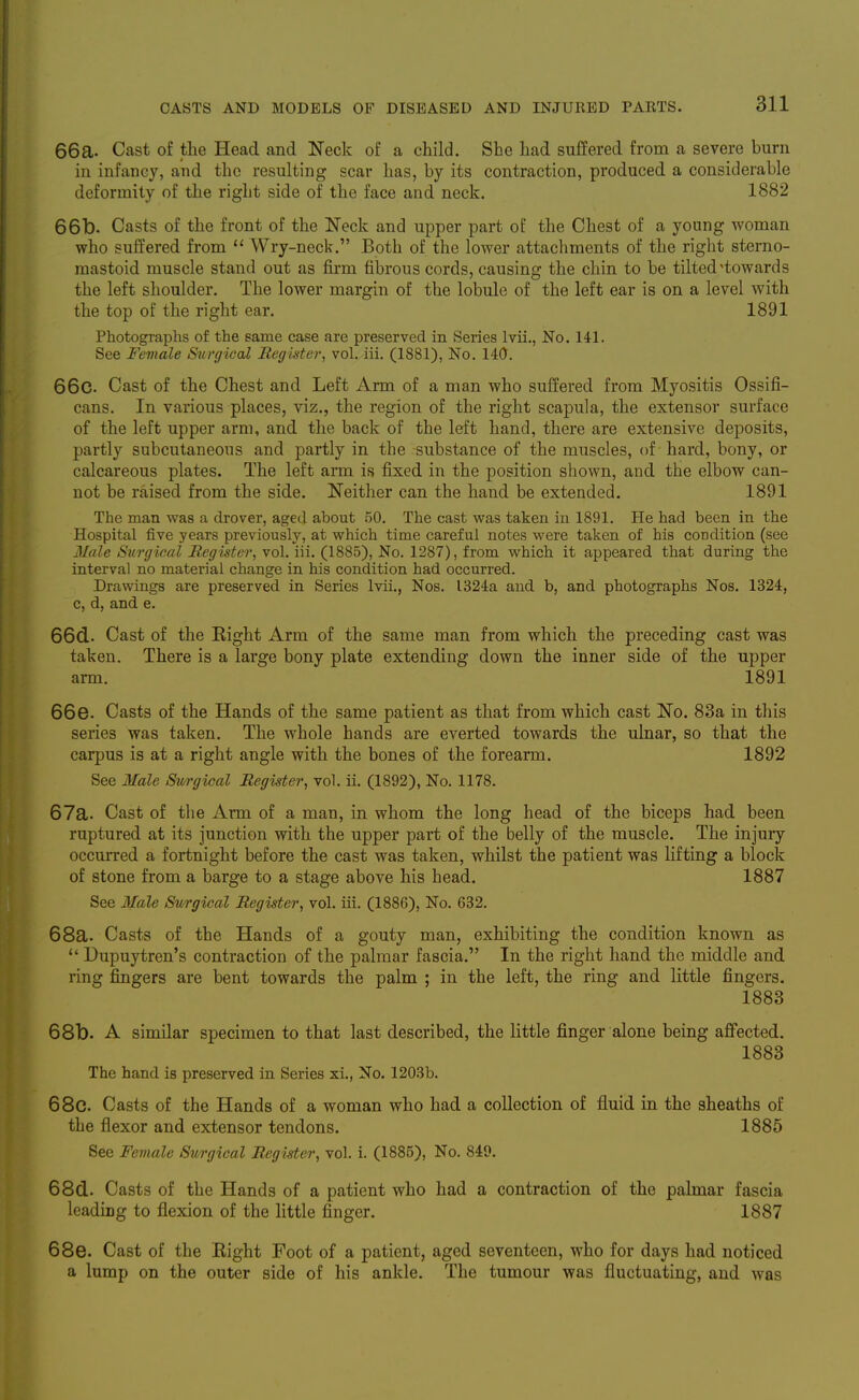 66a. Cast of the Head and Neck of a child. She had suffered from a severe burn in infancy, and the resulting scar has, by its contraction, produced a considerable deformity of the right side of the face and neck. 1882 66b. Casts of the front of the Neck and upper part of the Chest of a young woman who suffered from  Wry-neck. Both of the lower attachments of the right sterno- mastoid muscle stand out as firm fibrous cords, causing the chin to be tilted'towards the left shoulder. The lower margin of the lobule of the left ear is on a level with the top of the right ear. 1891 Photographs of the same case are preserved in Series Ivii,, No. 141. See Female Surgical Register, vol. iii. (1881), No. 140. 66c. Cast of the Chest and Left Arm of a man who suffered from Myositis Ossifi- cans. In various places, viz., the region of the right scapula, the extensor surface of the left upper arm, and the back of the left hand, there are extensive deposits, partly subcutaneous and partly in the substance of the muscles, of hard, bony, or calcareous plates. The left arm is fixed in the position shown, and the elbow can- not be raised from the side. Neither can the hand be extended. 1891 The man was a drover, aged about 50. The cast was taken in 1891. He had been in the Hospital five years previously, at which time careful notes were taken of his condition (see Male Surgical Register, vol. iii. (1885), No. 1287), from which it appeared that during the interval no material change in his condition had occurred. Drawings are preserved in Series Ivii., Nos. 1324a and b, and photographs Nos. 1324, c, d, and e. 66d. Cast of the Right Arm of the same man from which the preceding cast was taken. There is a large bony plate extending down the inner side of the upper arm. 1891 66e. Casts of the Hands of the same patient as that from which cast No. 83a in this series was taken. The whole hands are everted towards the ulnar, so that the carpus is at a right angle with the bones of the forearm. 1892 See Male Surgical Register, vol. ii. (1892), No. 1178. 67a. Cast of the Arm of a man, in whom the long head of the biceps had been ruptured at its junction with the upper part of the belly of the muscle. The injury occurred a fortnight before the cast was taken, whilst the patient was lifting a block of stone from a barge to a stage above his head. 1887 See 3Iale Surgical Register, vol. iii. (1886), No. 632. 68a. Casts of the Hands of a gouty man, exhibiting the condition known as  Dupuytren's contraction of the palmar fascia. In the right hand the middle and ring fingers are bent towards the palm ; in the left, the ring and little fingers. 1883 68b. A similar specimen to that last described, the little finger alone being afi'ected. 1883 The hand is preserved in Series xi., No. 1203b. 68c. Casts of the Hands of a woman who had a collection of fluid in the sheaths of the flexor and extensor tendons. 1885 See Female Surgical Register, vol. i. (1885), No. 849. 68(1. Casts of the Hands of a patient who had a contraction of the palmar fascia leading to flexion of the little finger. 1887 68e. Cast of the Right Foot of a patient, aged seventeen, who for days had noticed a lump on the outer side of his ankle. The tumour was fluctuating, and was