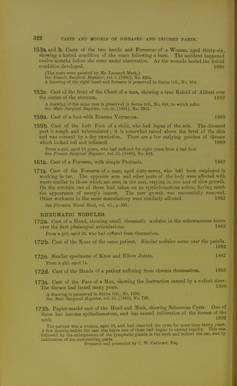 153a and b. Casts of the two hands and Forearms'of a Woman, aged tliirty-six, showing a keloid condition of the scars following a burn. The accident liappened twelve months before she came under observation. As the wounds healed the keloid condition developed. 1890 (The casts were painted by Mr. Leonard Mark.) See Female Surgical Begister, vol. i. (1890), No. 820a. A drawing of the right hand and forearm is preserved in Series Ivii., No. 854. 153c. Cast of the front of the Chest of a man, showing a true Keloid of Alibert over the centre of the sternum. 1892 A drawing of the same case is preserved in Series Ivii., No. 848, to which refer. See Male Surgical BegiMer, vol. iil. (1891), No. 2901. 159a. Cast of a foot with Eczema Verrucosa. 1883 159b. Cast of the Left Foot of a child, who had lupus of the sole. The diseased part is rough and tuberculated ; it is somewhat raised above the level of the skin and was covered by a dry exudation. There are a few outlying patches of disease which looked red and inflamed. 1889 From a girl, aged 13 years, who had suflEered for eight years from a bad foot. See Female Surgical Begister, vol. iii. (1889), No. 402. 161a. Cast of a Forearm, with simple Psoriasis. 1882 171a. Cast of the Forearm of a man, aged sixty-seven, who hM been employed in working in tar. The opposite arm and other parts of the body were affected with warts similar to those which are seen in the cast, varying in size and of slow growth. On the scrotum one of these had taken on an epitheliomatous action, having much the appearance of sweep's cancer. The new growth was successfully removed. Other workmen in the same manufactory were similarly affected. 1882 See Piteairn Ward Booh, vol. vii., p. 391. RHEUMATIC NODULES. 172a. Cast of a Hand, showing small rheumatic nodules in the subcutaneous tissue over the first phalangeal articulations. 1882 From a girl, aged 24, who had suffered from rheumatism. 172b. Cast of the Knee of the same patient. Similar nodules occur over the patella. 1882 172c. Similar specimens of Knee and Elbow Joints. 1882 From a girl, aged 14. 172d. Cast of the Hands of a patient suffering from chronic rheumatism. 1885 173a. Cast of the Face of a Man, showing the destruction caused by a rodent ulcer. The disease had lasted many years. ^ 890 A drawing is preserved in Series Ivii., No. 1292. See Male Surgical Begister, vol. iii. (1889), No. 746. 173b. Papier-mache' cast of the Head and Neck, showing Sebaceous Cysts. One of these has become epitheliomatous, and has caused infiltration of the tissues of the neck. The patient was a woman, aged 60, and had observed the cysts for more than thirty years. A few months before the cast was taken one of these had begun to extend rapidly. This was followed by the enlargement of the lymphatic glands in the neck and behind the ear, and by infiltration of the surrounding parts. Prepared and presented by C. W. Cathcart, Esq.