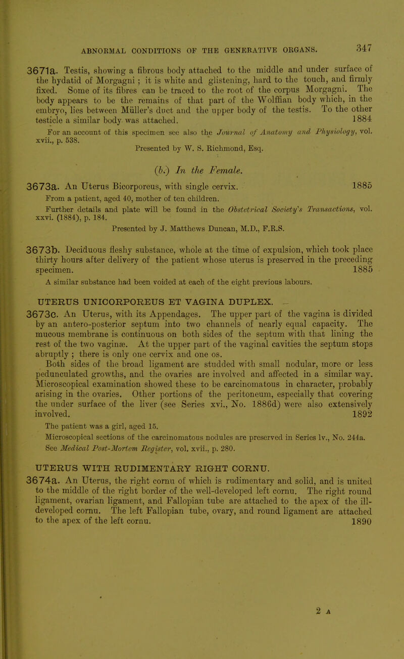 3671a. Testis, showing a fibrous body attached to the middle and under surface of the hydatid of Morgagni; it is white and glistening, hard to the touch, and firmly fixed. Some of its fibres can be traced to the root of the corpus Morgagni. _ The body appears to be the remains of that part of the Wolffian body which, in the embryo, lies between Miiller's duct and the upper body of the testis. To the other testicle a similar body was attached. 1884 For an account of this specimen see also the Journal of Anatomy and Physiology, vol. xvii., p. 538. Presented by W, S. Kichmond, Esq. (b.) In the Female. 3673a. An Uterus Bicorporeus, with single cervix. 1885 From a patient, aged 40, mother of ten children. Further details and plate will be found in the Obstetrical Society's Transactions, vol. xxvi. (1884), p. 184. Presented by J. Matthews Duncan, M.D., F.R.S. 3673b. Deciduous fleshy substance, whole at the time of expulsion, which took place thirty hours after delivery of the patient whose uterus is preserved in the preceding specimen. 1885 A similar substance had been voided at each of the eight previous labours. UTERUS UNICORPOREUS ET VAGINA DUPLEX. _ 3673c. An Uterus, with its Appendages. The upper part of the vagina is divided by an antero-posterior septum into two channels of nearly equal capacity. The mucous membrane is continuous on both sides of the septum with that lining the rest of the two vagin£e. At the upper part of the vaginal cavities the septum stops abruptly ; there is only one cervix and one os. Both sides of the broad ligament are studded with small nodular, more or less pedunculated growths, and the ovaries are involved and affected in a similar way. Microscopical examination showed these to be carcinomatous in character, probably arising in the ovaries. Other portions of the peritoneum, especially that covering the under surface of the liver (see Series xvi., No. 1886d) were also extensively involved. 1892 The patient was a girl, aged 15. Microscopical sections of the carcinomatous nodules are preserved in Series Iv,, No. 244a. See Medical Post-Mortem Register, vol. xvii., p. 280. UTERUS WITH RUDIMENTARY RIGHT CORNU. 3674a. An Uterus, the right corau of which is rudimentary and solid, and is united to the middle of the right border of the well-developed left cornu. The right round ligament, ovarian ligament, and Fallopian tube are attached to the apex of the ill- developed cornu. The left Fallopian tube, ovary, and round ligament are attached to the apex of the left cornu. 1890 2 A