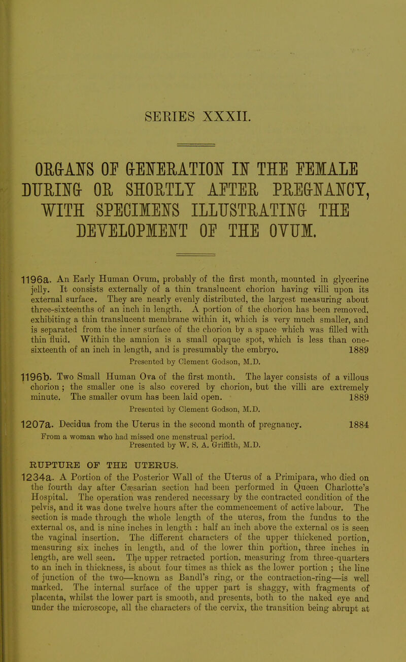 OR&ANS OF aEIERATIOI U THE FEIALE mMSGr OR SHORTLY APTEE PEEaiAICT, WITH SPECIIEIS ILLTJSTMTn& THE DEYELOPMEIT OF THE OYUM. 1196a. An Early Human Ovum, probably of the first month, mounted in glycerine jelly- It consists externally of a thin translucent chorion having villi upon its external surface. They are nearly evenly distributed, the largest measuring about three-sixteenths of an inch in length. A portion of the chorion has been removed, exhibiting a thin translucent membrane within it, vfhich is very much smaller, and is separated from the inner surface of the chorion by a space which was filled with thin fluid. Within the amnion is a small opaque spot, which is less than one- sixteenth of an inch in length, and is presumably the embryo. 1889 Presented by Clement Godson, M.D. 1196b. Two Small Human Ova of the first month. The layer consists of a villous chorion ; the smaller one is also covered by chorion, but the villi are extremely minute. The smaller ovum has been laid open. 1889 Presented by Clement Godson, M.D. 1207a. Decidua from the Uterus in the second month of pregnancy. 1884 From a woman who had missed one menstrual period. Presented by W. S. A. Griffith, M.D. RUPTURE OF THE UTERUS. 1234a. A Portion of the Posterior Wall of the Uterus of a Primipara, who died on the fourth day after Cassarian section had been performed in Queen Charlotte's Hospital. The operation was rendered necessary by the contracted condition of the pelvis, and it was done twelve hours after the commencement of active labour. The section is made through the whole length of the uterus, from the fundus to the external os, and is nine inches in length : half an inch above the external os is seen the vaginal insertion. The different characters of the upper thickened portion, measuring six inches in length, and of the lower thin portion, three inches in length, are well seen. The upper retracted portion, measuring from three-quarters to an inch in thickness, is about four times as thick as the lower portion ; the line of junction of the two—known as Bandl's ring, or the contraction-ring—is well marked. The internal surface of the upper part is shaggy, with fragments of placenta, whilst the lower part is smooth, and presents, both to the naked eye and under the microscope, all the characters of the cervix, the transition being abrupt at