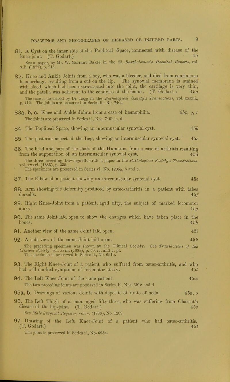 81. A Cyst on the inner side of the Popliteal Space, connected with disease of the knee-joint. (T. Godart.) 45 See a paper, by Mr. W. Morrant Baker, in the St. Bartholomew's Hospital Bcjyorts, vol. xiii. (1877), p. 245. 82. Knee and Ankle Joints from a boy, who was a bleeder, and died from continuous haemorrhage, resulting from a cut on the lip. The synovial membrane is stained with blood, which had been cxtravasated into the joint, the cartilage is very thin, and the patella was adherent to the condyles of the femur. (T. Godart.) 45a The case is described by Dr. Legg in the Pathological Society's Transactions, vol. xxxiii., p. 412. The joints are preserved in Series ii., No. 740a. 83a, t>, C Knee and Ankle Joints from a case of haemophilia. 45;), q, r The joints are preserved in Scries ii., Nos. 740b, c, d. 84. The Popliteal Space, showing an intermuscular synovial cyst. 455 85. The posterior aspect of the Leg, showing an intermuscular synovial cyst. 45c 86. The head and part of the shaft of the Humerus, from a case of arthritis resulting from the suppuration of an intermuscular synovial cyst. 45a1 The three preceding drawings illustrate a paper in the Pathological Society's Transactions, vol. xxxvi. (1885), p. 335. The specimens are preserved in Series vi., No. 1205a, b and e. 87. The Elbow of a patient showing an intermuscular synovial cyst. 45<? 88. Arm showing the deformity produced by osteo-arthritis in a patient with tabes dorsalis. 45/ 89. Right Knee-Joint from a patient, aged fifty, the subject of marked locomotor ataxy. 45^ 90. The same Joint laid open to show the changes which have taken place in the bones. 457t 91. Another view of the same Joint laid open. 45e 92- A side view of the same Joint laid open. 45& The preceding specimen was shown at the Clinical Society. See Transactions of the Clinical Society, vol. xviii. (1885), p. 50, iv. and v. pi. The specimen is preserved in Series ii., No. 691b. 93. The Right Knee-Joint of a patient who suffered from osteo-arthritis, and who had well-marked symptoms of locomotor ataxy. 45Z 94. The Left Knee-Joint of the same patient. 45m The two preceding joints are preserved in Series, ii., Nos. 691c and d. 95a, b. Drawings of various Joints with deposits of urate of soda. 45w, o 96. The Left Thigh of a man, aged fifty-three, who was suffering from Charcot's disease of the hip-joint. (T. Godart.) 45* See Male Surgical Register, vol. v. (1886), No. 1209. 97. Drawing of the Left Knee-Joint of a patient who had osteo-arthritis. (T. Godart.) 45< The joint is preserved in Series ii., No. 693a.