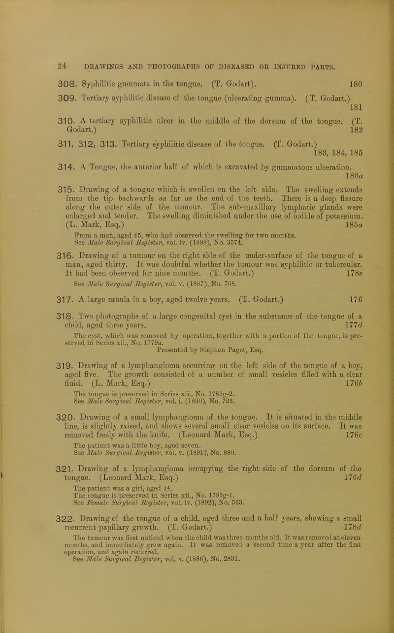 308. Syphilitic gummata in the tongue. (T. Godart). 180 309. Tertiary syphilitic disease of the tongue (ulcerating gumma). (T. Godart.) 181 310. A tertiary syphilitic ulcer in the middle of the dorsum of the tongue. (T. Godart.) 182 311. 312, 313. Tertiary syphilitic disease of the tongue. (T. Godart.) 188, 184, 185 314. A Tongue, the anterior half of which is excavated by gummatous ulceration. 180a 315. Drawing of a tongue which is swollen on the left side. The swelling extends from the tip backwards as far as the end of the teeth. There is a deep fissure along the outer side of the tumour. The sub-maxillary lymphatic glands were enlarged and tender. The swelling diminished under the use of iodide of potassium. (L. Mark, Esq.) 185a From a man, aged 45, who had observed the swelling for two months. See Male Surgical Register, vol. iv. (1888), No. 3574. 316- Drawing of a tumour on the right side of the under-surface of the tongue of a man, aged thirty. It was doubtful whether the tumour was syphilitic or tubercular. It had been observed for nine months. (T. Godart.) 178e See Male Surgical Register, vol. v. (1887), No. 768. 317. A large ranula in a boy, aged twelve years. (T. Godart.) 176 318. Two photographs of a large congenital cyst in the substance of the tongue of a child, aged three years. 177d The cyst, which was removed by operation, together with a portion of the tongue, is pre- served in Series xii., No. 1779a. Presented by Stephen Paget, Esq. 319. Drawing of a lymphangioma occurring on the left side of the tongue of a boy, aged five. The growth consisted of a number of small vesicles filled with a clear fluid. (L. Mark, Esq.) 1766 The tongue is preserved in Series xii., No. 1785g-2. See Male Surgical Register, vol. i. (1890), No. 725. 320. Drawing of a small lymphangioma of the tongue. It is situated in the middle line, is slightly raised, and shows several small clear vesicles on its surface. It was removed freely with the knife. (Leonard Mark, Esq.) 176c The patient was a little boy, aged seven. See Male Surgical Register, vol. v. (1891), No. 880. 321. Drawing of a lymphangioma occupying the right side of the dorsum of the tongue. (Leonard Mark, Esq.) 176c? The patient was a girl, aged 14. The tongue is preserved in Series xii., No. 17S5g-l. See Female Surgical Register, vol. iv. (1892), No. 563. 322. Drawing of the tongue of a child, aged three and a half years, showing a small recurrent papillary growth. (T. Godart.) 178rf The tumour was first noticed when the child was three months old. It was removed at eleven months, and immediately grew again. It was removed a second time a year after the first operation, and again recurred. See Male Surgical Register, vol. v. (1886), No. 2831.