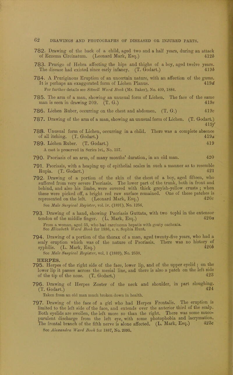 782. Drawing of the back of a child, aged two and a half years, during an attack of Eczema Circinatum. (Leonard Mark, Esq.) 4126 783. Prurigo of Hebra affecting the hips and thighs of a boy, aged twelve years. The disease had existed since early infancy. (T. Godart.) 4196 784. A Pruriginous Eruption of an uncertain nature, with an affection of the gums. It is perhaps an exaggerated form of Lichen Planus. 419d For further details see Sitwell Ward Booh (Mr. Baker), No. 409, 1884. 785. The arm of a man, showing an unusual form of Lichen. The face of the same man is seen in drawing 209. (T. G.) 419e 786. Lichen Ruber, occurring on the chest and abdomen. (T. G.) 419c 787. Drawing of the arm of a man, showing an unusual form of Lichen. (T. Godart.) 419/ 788. Unusual form of Lichen, occurring in a child. There was a complete absence of all itching. (T. Godart.) 419a 789. Lichen Ruber. (T. Godart.) 419 A cast is preserved in Series lvi., No. 167. 790. Psoriasis of an arm, of many months' duration, in an old man. 420 791. Psoriasis, with a heaping up of epithelial scales in such a manner as to resemble Rupia. (T. Godart.) 421 792. Drawing of a portion of the skin of the chest of a boy, aged fifteen, who suffered from very severe Psoriasis. The lower part of the trunk, both in front and behind, and also his limbs, were covered with thick greyish-yellow crusts ; when these were picked off, a bright red raw surface remained. One of these patches is represented on the left. (Leonard Mark, Esq.) 420c See Male Surgical Register, vol. iv. (1891), No. 1256. 793. Drawing of a hand, showing Psoriasis Guttata, with two tophi in the extensor tendon of the middle finger. (L. Mark, Esq.) 420a From a woman, aged 55, who had carcinoma hepatis with gouty cachexia. See Elizabeth Ward Booh for 1886, s. v, Sophia Hunt. 794. Drawing of a portion of the thorax of a man, aged twenty-five years, who had a scaly eruption which was of the nature of Psoriasis. There was no history of syphilis. (L. Mark, Esq.) 4206 See Male Swgical Register, vol. 1 (1889), No. 2538. HERPES. 795. Herpes of the right side of the face, lower lip, and of the upper eyelid ; on the lower lip it passes across the mesial line, and there is also a patch on the left side of the tip of the nose. (T. Godart.) 423 796. Drawing of Herpes Zoster of the neck and shoulder, in part sloughing. (T. Godart.) 424 Taken from an old man much broken down in health. 797. Drawing of the face of a girl who had Herpes Frontalis. The eruption is limited to the left side of the face, and extends over the anterior third of the scalp. Both eyelids are swollen, the left more so than the right. There was some muco- purulent discharge from the left eye, with some photophobia and lacrymation. The frontal branch of the fifth nerve is alone affected. (L. Mark, Esq.) 423c See Alexandra Ward Booh for 1887, No. 2095.
