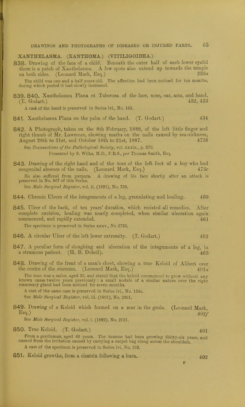 XANTHELASMA. (XANTHOMA.) (VITILIGOIDEA.) 838- Drawing of the face of a child. Beneath tin: outer half of each lower eyelid there is a patch of Xanthelasma. A few spots also extend up towards the temple on both sides. (Leonard Mark, Esq.) 233a The child was one and a half years old. The affection had been noticed for tea months, during which period it had slowly increased. 839, 840. Xanthelasma Plana et Tuberosa of the face, nose, ear, arm, and hand. (T. Godart.) 432, 433 A cast of the hand is preserved in Series lvi., No. 163. 841. Xanthelasma Plana on the palm of the hand. (T. Godart.) 434 842. A Photograph, taken on the 8th February, 1888, of the left little finger and right thumb of Mr. Lawrence, showing marks on the nails caused by sea-sickness, August 28th to 31st, and October 18th to 21st, 1887. 4736 See Transactions of the Pathological Society, vol. xxxix., p. 370. Presented by S. Wilks, M.D., F.R.S., per Thomas Smith, Esq. 843. Drawing of the right hand and of the toes of the left foot of a boy who had congenital absence of the nails. (Leonard Mark, Esq.) 473c He also suffered from purpura. A drawing of his face shortly after an attack is preserved in No. 867 of this Series. See Male Surgical Register, vol. ii. (1891), No. 736. 844. Chronic Ulcei'S of the integuments of a leg, granulating and healing. 460 845. Ulcer of the back, of ten years' duration, which resisted all remedies. After complete excision, healing was nearly completed, when similar ulceration again commenced, and rapidly extended. 461 The specimen is preserved in Series xxxv., No 2720. 846. A circular Ulcer of the left lower extremity. (T. Godart.) 462 847. A peculiar form of sloughing and ulceration of the integuments of a leg, in a strumous patient. (H. B. Dobell). 463 848. Drawing of the front of a man's chest, showing a true Keloid of Alibert over the centre of the sternum. (Leonard Mark, Esq.) 401 a The man was a sailor, aged 35, and stated that the keloid commenced to grow without any known cause twelve years previously : a small nodule of a similar nature over the right mammary gland had been noticed for seven months. A cast of the same case is preserved in Series lvi., No. 153c. See Male Surgical Register, vol. iii. (1891), No. 2901. 849. Drawing of a Keloid which formed on a scar in the groin. (Leonard Mark, Esq-) 402/ See Male Surgical Register, vol. i. (1892), No. 2121. 850. True Keloid. (T. Godart.) 401 From a gentleman, aged 65 years. The tumour had been growing thirty-six years and ensued from the irritation caused by carrying a carpet bag slung across the shoulders. A cast of the specimen is preserved in Series lvi, No. 153. 851. Keloid growths, from a cicatrix following a burn. 402