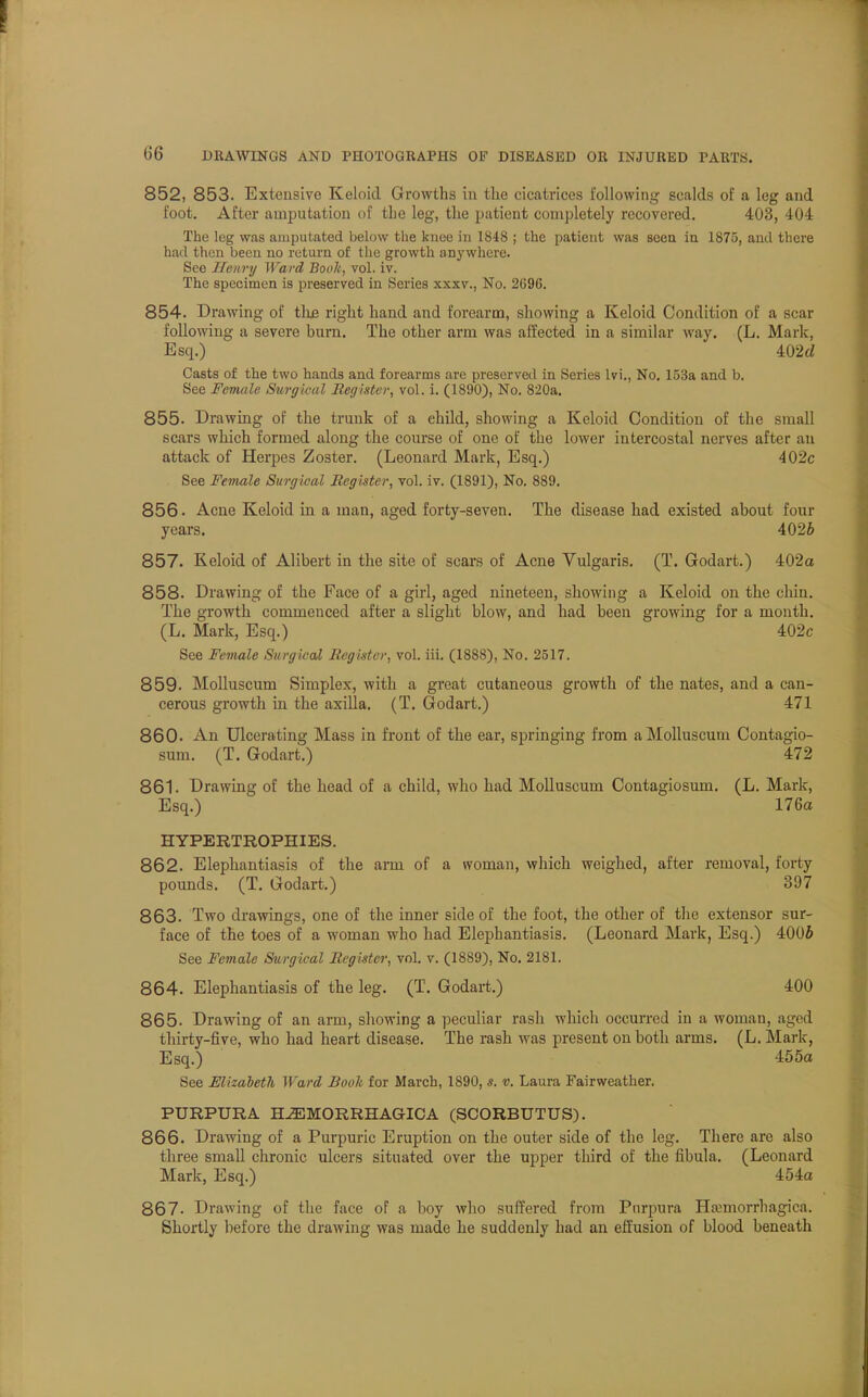 852, 853. Extensive Keloid Growths in the cicatrices following scalds of a leg and foot. After amputation of the leg, the patient completely recovered. 403, 404 The leg was amputated below the knee in 1848 ; the patient was seen in 1875, and there had then been no return of the growth anywhere. See Henry Ward Book, vol. iv. The specimen is preserved in Series xxxv., No. 2G96. 854. Drawing of the right hand and forearm, showing a Keloid Condition of a scar following a severe burn. The other arm was affected in a similar way. (L. Mark, Esq.) 402rf Casts of the two hands and forearms are preserved in Series lvi., No. 153a and b. See Female Surgical Register, vol. i. (1890), No. 820a. 855. Drawing of the trunk of a child, showing a Keloid Condition of the small scars which formed along the course of one of the lower intercostal nerves after an attack of Herpes Zoster. (Leonard Mark, Esq.) 402c See Female Surgical Register, vol. iv. (1891), No. 889. 856. Acne Keloid in a man, aged forty-seven. The disease had existed about four years. 4026 857. Keloid of Alibert in the site of scars of Acne Vulgaris. (T. Godart.) 402a 858. Drawing of the Face of a girl, aged nineteen, showing a Keloid on the chin. The growth commenced after a slight blow, and had been growing for a month. (L. Mark, Esq.) 402c See Female Surgical Register, vol. iii. (1888), No. 2517. 859. Molluscum Simplex, with a great cutaneous growth of the nates, and a can- cerous growth in the axilla. (T. Godart.) 471 860. An Ulcerating Mass in front of the ear, springing from a Molluscum Contagio- sum. (T. Godart.) 472 861. Drawing of the head of a child, who had Molluscum Contagiosum. (L. Mark, Esq.) 176a HYPERTROPHIES. 862. Elephantiasis of the arm of a woman, which weighed, after removal, forty pounds. (T. Godart.) 397 863. Two drawings, one of the inner side of the foot, the other of the extensor sur- face of the toes of a woman who had Elephantiasis. (Leonard Mark, Esq.) 4006 See Female Surgical Register, vol. v. (1889), No. 2181. 864. Elephantiasis of the leg. (T. Godart.) 400 865- Drawing of an arm, showing a peculiar rash which occurred in a woman, aged thirty-five, who had heart disease. The rash was present on both arms. (L. Mark, Esq.) 455a See Elizabeth Ward Book for March, 1890, s. v. Laura Fairweather. PURPURA HEMORRHAGICA (SCORBUTUS). 866. Drawing of a Purpuric Eruption on the outer side of the leg. There are also three small chronic ulcers situated over the upper third of the fibula. (Leonard Mark, Esq.) 454a 867. Drawing of the face of a boy who suffered from Purpura Hemorrhagica. Shortly before the drawing was made he suddenly had an effusion of blood beneath