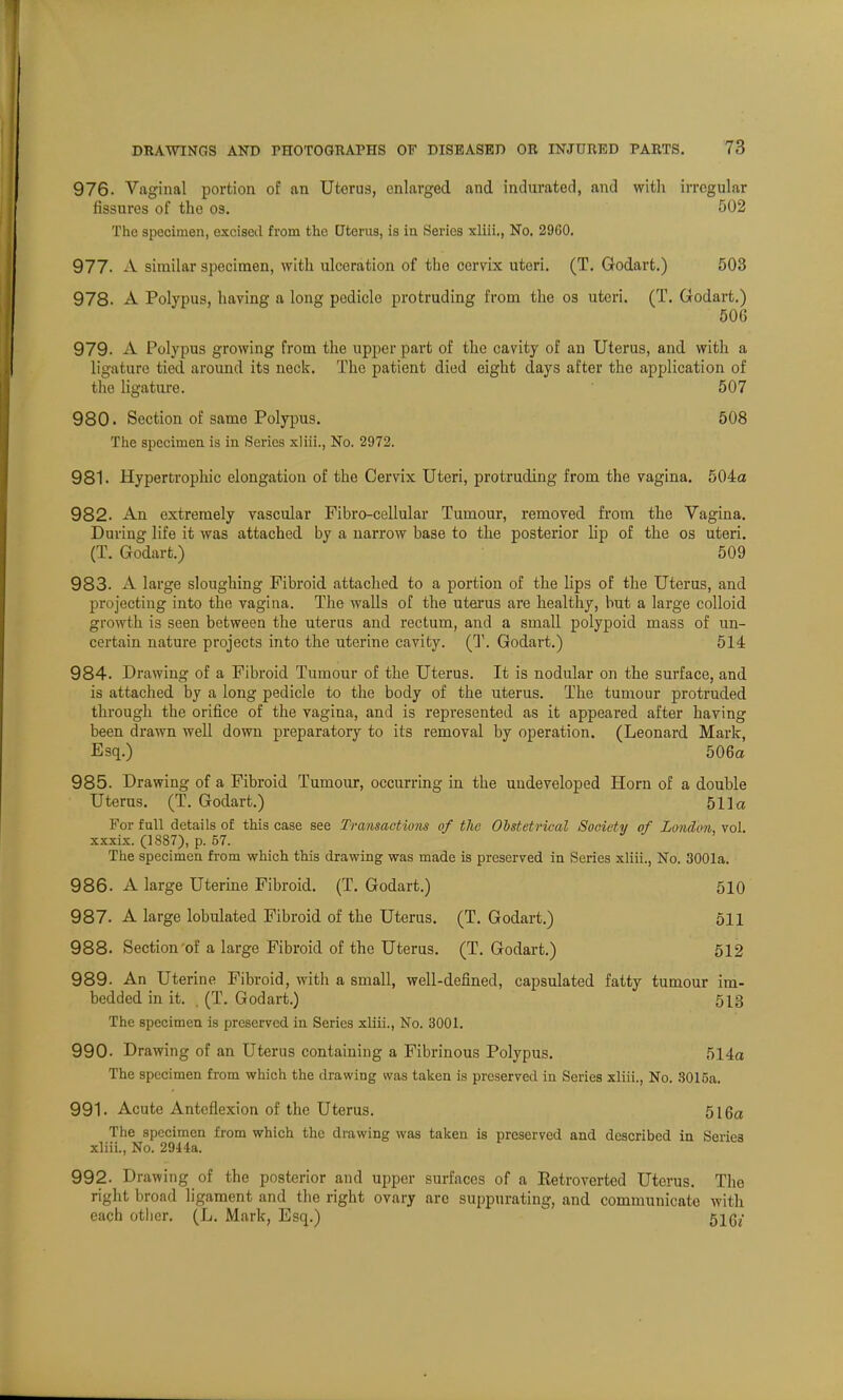 976. Vaginal portion of an Uterus, enlarged and indurated, and with irregular fissures of the os. 502 The specimen, excised from the Dterus, is in Series xliii., No. 29G0. 977. A similar specimen, with ulceration of the cervix uteri. (T. Godart.) 503 978. A Polypus, having a long pedicle protruding from the os uteri. (T. Godart.) 50G 979. A Polypus growing from the upper part of the cavity of an Uterus, and with a ligature tied around its neck. The patient died eight days after the application of the ligature. 507 980. Section of same Polypus. 508 The specimen is in Series xliii., No. 2972. 981. Hypertrophic elongation of the Cervix Uteri, protruding from the vagina. 504a 982. An extremely vascular Fibro-cellular Tumour, removed from the Vagina. During life it was attached by a nari'ow base to the posterior lip of the os uteri. (T. Godart.) 509 983. A large sloughing Fibroid attached to a portion of the Hps of the Uterus, and projecting into the vagina. The walls of the uterus are healthy, but a large colloid growth is seen between the uterus and rectum, and a small polypoid mass of un- certain nature projects into the uterine cavity. (T. Godart.) 514 984. Drawing of a Fibroid Tumour of the Uterus. It is nodular on the surface, and is attached by a long pedicle to the body of the uterus. The tumour protruded through the orifice of the vagina, and is represented as it appeared after having been drawn well down preparatory to its removal by operation. (Leonard Mark, Esq.) 506a 985. Drawing of a Fibroid Tumour, occurring in the undeveloped Horn of a double Uterus. (T. Godart.) 511a For full details of this case see Transactions of the Obstetrical Society of London, vol. xxxix. (1887), p. 57. The specimen from which this drawing was made is preserved in Series xliii., No. 3001a. 986. A large Uterine Fibroid. (T. Godart.) 510 987. A large lobulated Fibroid of the Uterus. (T. Godart.) 511 988. Section of a large Fibroid of the Uterus. (T. Godart.) 512 989. An Uterine Fibroid, with a small, well-defined, capsulated fatty tumour im- bedded in it. , (T. Godart.) 513 The specimen is preserved in Series xliii., No. 3001. 990. Drawing of an Uterus containing a Fibrinous Polypus. 514a The specimen from which the drawing was taken is preserved in Series xliii., No. 3015a. 991. Acute Anteflexion of the Uterus. 516a The specimen from which the drawing was taken is preserved and described in Series xliii., No. 2944a. 992. Drawing of the posterior and upper surfaces of a Retroverted Uterus. The right broad ligament and the right ovary are suppurating, and communicate with each other. (L. Mark, Esq.) 51g;-