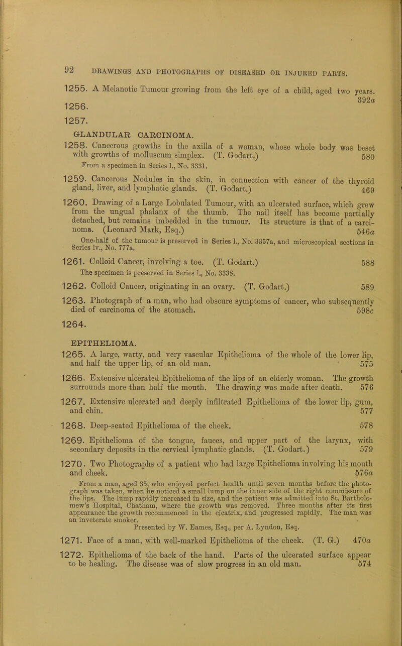 1255. A Melanotic Tumour growing from the left eye of a child, aged two years. 392a 1256. 1257. GLANDULAR CARCINOMA. 1258. Cancerous growths in the axilla of a woman, whose whole body was beset with growths of molluscum simplex. (T. Godart.) 580 From a specimen in Series 1., No. 3331. 1259. Cancerous Nodules in the skin, in connection with cancer of the thyroid gland, liver, and lymphatic glands. (T. Godart.) 469 1260. Drawing of a Large Lobulated Tumour, with an ulcerated surface, which grew from the ungual phalanx of the thumb. The nail itself has become partially detached, but remains imbedded in the tumour. Its structure is that of a carci- noma. (Leonard Mark, Esq.) 54g0 One-half of the tumour is preserved in Series 1., No. 3357a, and microscopical sections in Series lv., No. 777a. 1261. Colloid Cancer, involving a toe. (T. Godart.) 588 The specimen is preserved iu Series L, No. 3338. 1262. Colloid Cancer, originating in an ovary. (T. Godart.) 589 1263. Photograph of a man, who had obscure symptoms of cancer, who subsequently died of carcinoma of the stomach. 598c 1264. EPITHELIOMA. 1265. A large, warty, and very vascular Epithelioma of the whole of the lower lip, and half the upper lip, of an old man. ' 575 1266- Extensive ulcerated Epithelioma of the lips of an elderly woman. The growth surrounds more than half the mouth. The drawing was made after death. 576 1267. Extensive ulcerated and deeply infiltrated Epithelioma of the lower lip, gum, and chin. 577 1268. Deep-seated Epithelioma of the cheek. 578 1269. Epithelioma of the tongue, fauces, and upper part of the larynx, with secondary deposits in the cervical lymphatic glands. (T. Godart.) 579 1270- Two Photographs of a patient who had large Epithelioma involving his mouth and cheek. 576a From a man, aged 35, who enjoyed perfect health until seven months before the photo- graph was taken, when he noticed a small lump on the inner side of the right commissure of the lips. The lump rapidly increased in size, and the patient was admitted into St. Bartholo- mew's Hospital, Chatham, where the growth was removed. Three months after its first appearance the growth recommenced in the cicatrix, and progressed rapidly. The man was an inveterate smoker. Presented by W. Eames, Esq., per A. Lyndon, Esq. 1271. Face of a man, with well-marked Epithelioma of the cheek. (T. G.) 470a 1272. Epithelioma of the back of the hand. Parts of the ulcerated surface appear to be healing. The disease was of slow progress in an old man. 574