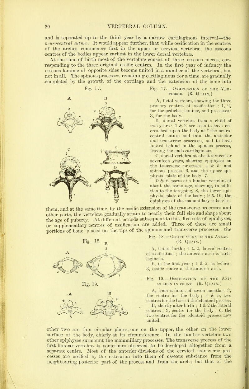 and is separated up to tlie third year by a narrow cartilaginous interval—the neuroccntml ttuturc. It would appear further, that while ossification in the centres of the arches commences first in the upper or cervical vertebras, the osseous centres of the bodies appear earliest in the lower dorsal vertebrge. At the time of birth most of the vertebras consist of three osseous pieces, cor- responding to the three original ossific centres. In the first year of infancy the osseous laminse of opposite sides become united in a number of the vertebras, but; not in all. The spinous processes, remaining cartilaginous for a time, are gradually <;ompleted by the growth of the cartilage and the extension of the bone into Fi-. 1 Vi 17.—Ossification op the tebr^. (r. quain.) A, fcetal vertebra, showing the three primary centres of ossification ; 3, 2, for the pedicles, laminte, and processes ; 3, for the body. B, dorsal vertebra from a child of two years ; 1 & 2 are seen to have en- croached upon the body at the neuro- central suture and into the articular and transverse processes, and to Jiave united behind in the spinous process, leaving the ends cartilaginous. C, dorsal vertebra at about sixteen or seventeen years, showing epiphyses on the transverse processes, 4 & 5, and spinous pi'ocess, 6, and the upper epi- physial plate of the body, 7. D & E, pai-ts of a lumbar vertebra of about the same age, showing, in addi- tion to the foregoing, 8, the loAver epi- physial plate of the body ; 9 & 10, the epiphyses of the mammillary tubercles. them, and at the same time, by the ossific extension of the transverse processes and other parts, the vertebrte gradually attain to nearly their full size and shape about the age of puberty. At different periods subsequent to this, five sets of epiphyses, or supplementary centres of ossification, are added. Three of these are small portions of bone, placed on the tips of the spinous and transverse processes : the Fig. 18.—Ossification op the Atlas. (E. QUAIN. ) A, before birth ; 1 & 2, lateral centres of ossification ; the anterior arch is carti- laginous. B, in the fii'st year ; 1 & 2, as 1-iefore ; 3, ossific centre in the anterior arcli. Fig. 19.—Ossification op the Axis AS SEEN in FKONT. (R. QuAIN.) A, from a foetus of seven months ; 3, the centre for the body ; 4 & 5, two centres for the base of the odontoid process. B, shortly after birth ; 1 & 2 the lateral centres ; 3, centre for the body ; 6, the two centres for the odontoid process now united. other two are thin circular plates, one on the upper, the other on the lov/er surface of the body, chiefly at its circumference. In the lumbar vertebras two other epiphyses surmount the mammillary processes. The transverse process of. the 'first lumbar vertebra is sometimes observed to be developed altogether from a separate centre. Most of the anterior divisions of the cervical transverse pro- cesses are ossified by the extension into them of osseous substance from the neighbouring posterior part of the process and from the arch; but that of the Fig. 19.
