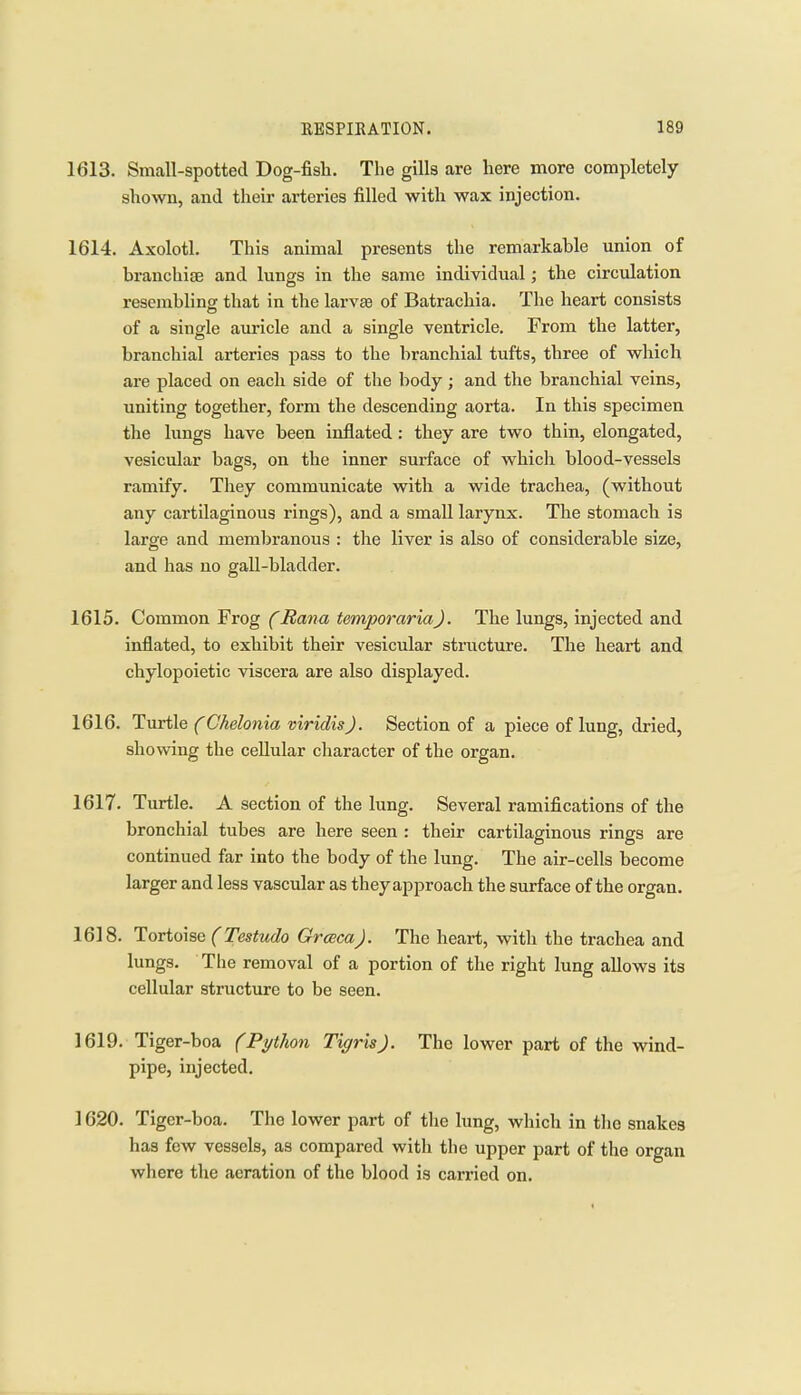 1613. Small-spotted Dog-fisli. The gills are here more completely shown, and their arteries filled with wax injection. 1614. Axolotl. This animal presents the remarkable union of branchiae and lungs in the same individual; the circxilation resembling that in the larvte of Batrachia. The heart consists of a single auricle and a single ventricle. From the latter, branchial arteries pass to the branchial tufts, three of which are placed on each side of the body; and the branchial veins, uniting together, form the descending aorta. In this specimen the lungs have been inflated : they are two thin, elongated, vesicular bags, on the inner surface of which blood-vessels ramify. They communicate with a wide trachea, (without any cartilaginous rings), and a small larynx. The stomach is large and membranous : the liver is also of considerable size, and has no gall-bladder. 1615. Common Frog (Bana temporariaj. The lungs, injected and inflated, to exhibit their vesicular structure. The heart and chylopoietic viscera are also displayed. 1616. Turtle (Chelonia viridisj. Section of a piece of lung, dried, showing the cellular character of the organ. 1617. Turtle. A section of the lung. Several ramifications of the bronchial tubes are here seen : their cartilaginous rings are continued far into the body of the lung. The air-cells become larger and less vascular as theyapproach the surface of the organ. 1618. Tortoise (Testudo Grceca). The heart, with the trachea and lungs. The removal of a portion of the right lung allows its cellular structure to be seen. 1619. Tiger-boa (Python Tigris). The lower part of the wind- pipe, injected. 1620. Tiger-boa. The lower part of the lung, which in the snakes has few vessels, as compared with the upper part of the organ where the aeration of the blood is carried on.