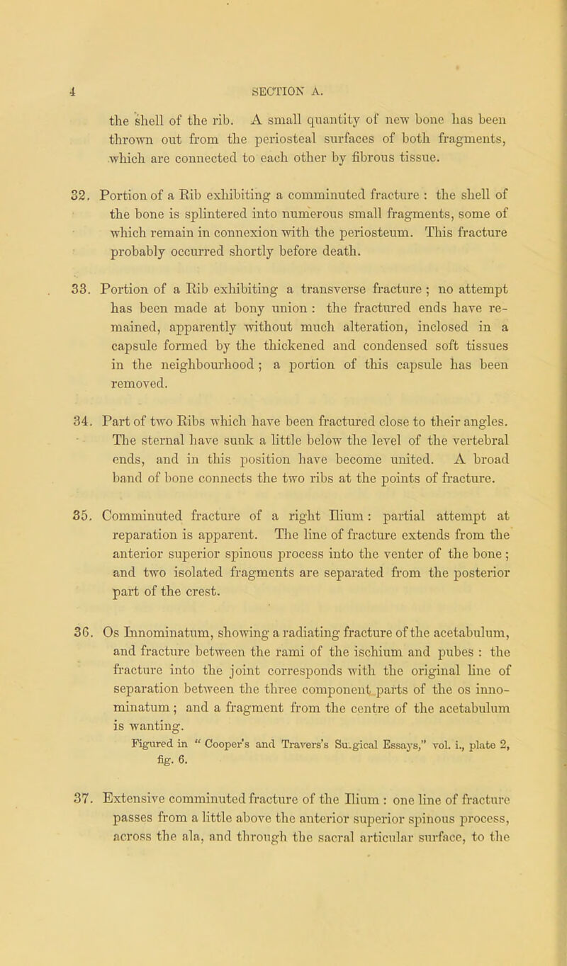 the shell of the rib. A small qnantitj^ of ncvp bone lias been thro-\Tn out from the periosteal siu-faces of both fragments, which are connected to each other by fibrous tissue. 32. Portion of a Rib exhibiting a comminuted fracture : the shell of the bone is splintered into nunierous small fragments, some of which remain in connexion with the periosteum. This fracture probably occurred shortly before death. 33. Portion of a Rib exhibiting a transverse fracture ; no attempt has been made at bony union : the fractured ends have re- mained, apparently without much alteration, inclosed in a capsule formed by the thickened and condensed soft tissues in the neighbourhood ; a portion of this capsule has been removed. 34 . Part of two Ribs which have been fractured close to their angles. Tlie sternal have sunk a little below the level of the vertebral ends, and in this j^osition have become united. A broad band of bone connects the two ribs at the points of fracture. 35. Comminuted fracture of a right Hium: partial attempt at reparation is apparent. The line of fracture extends from the anterior superior sijinous process into the venter of the bone; and two isolated fragments are separated from the posterior part of the crest. 3G. Os Innominatum, showing a radiating fracture of the acetabulum, and fracture between the rami of the ischium and pvibes : the fracture into the joint corresponds with the original Hue of separation between the three component parts of the os inno- minatum ; and a fragment from the centre of the acetabulum is wanting. Figured in  Cooper s and Travers's Su.gical Essays, vol. i., plate 2, fig. 6. 37. Extensive comminuted fracture of the Ilium : one line of fracture passes from a little above the anterior superior spinous process, across the ala, and through the sacral articular surface, to the