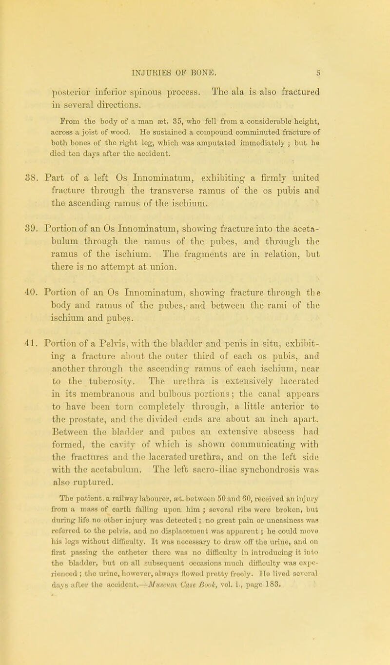 posterior inferior spinous process. The iila is also fractured in several directions. From the body of a man sat. 35, who fell from a considerable height, across a joist of wood. He sustained a compound comminuted fractm-e of both bones of the right leg, which was amputated immediately ; but ha died tea da^'s after the accident. 38. Part of a left Os Innominatum, exLibiting a firmly united fracture througli the transverse ramus of the os pubis and the ascending ramus of the ischium. 39. Portion of an Os Innominatum, showing fracture into the aceta- bulum through the ramus of the pubes, and through the ramus of the ischium. The fragments are in relation, but there is no attempt at union. 40. Portion of an Os Innominatum, showing fracture through the body and ramus of the pubes,- and between the rami of the ischium and pubes. 41. Portion of a Pelvis, with the bladder and penis in situ, exhibit- ing a fracture about the outer third of each os pubis, and another through the ascending ramus of each ischium, near to the tuberosity. The urethra is extensively lacerated in its membranous and bulbous portions; the canal appears to have been torn completely through, a little anterior to the prostate, and llie divided ends are about an inch apart. Between the bladder and piibes an exten.sive abscess had formed, the cavity of which is shown communicating with the fractures and tiie lacerated urethra, and on the left side with the acetabulum. The left sacro-iliac synchondrosis was also ruptured. Tlie patient, a railway labom-er, a?t. between 50 and 60, received an injury from a ma.ss of earth falling upon him ; several ribs were broken, but during life no other inj\iry was detected; no great pain or uneasiness wits referred to the pelvis, and no displacement was apparent; ho could move his legs without difficulty. It was necessary to draw off the urine, and on first passing the catheter there was no difficulty in introducing it into tho bladder, but on all Kubsequent occasions nuich difficulty was expc- rioiioed ; the urine, however, always flowed pretty frooly. Ho lived sevonil d.'iys after the accident.—^jl/u^raw Case Book, vol. i., page 183.