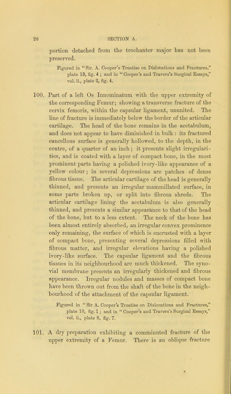 portion detached from the trochanter major has not been preserved. Figured in Sir. A. Cooper's Treatise on Dislocations and Fractures, plate 13, fig. 4 ; and in  Cooper's and Travers's Surgical Essays, vol. ii., plate 2, fig. 4. 100. Part of a left Os Innominatum with the upper extremity of the corresponding Femur; showing a transverse fracture of the cervix femoris, within the capsular ligament, ununited. The line of fracture is immediately below the border of the articular cartilage. The head of the bone remains in the acetabulum, and does not appear to have diminished in bulk: its fractured cancellous surface is generally hollowed, to the depth, in the centre, of a quarter of an inch ; it presents slight irregulari- ties, and is coated with a layer of compact bone, in the most prominent parts having a polished ivory-like appearance of a yellow colour; in several depressions are patches of dense fibrous tissue. The articular cartilage of the head is generally thinned, and presents an irregular mammillated surface, in some parts broken up, or split into fibrous shreds. The articular cartilage lining the acetabulum is also generally thinned, and presents a similar appearance to that of the head of the bone, but to a less extent. The neck of the bone has been almost entirely absorbed, an irregular convex prominence only remaining, the surface of which is encrusted with a layer of compact bone, presenting several depressions filled with fibrous matter, and irregular elevations having a poUshed ivory-like surface. The capsular ligament and the fibrous tissues in its neighbourhood are much thickened. The syno- vial membrane presents an in-egularly thickened and fibrous appearance. Irregular nodvdes and masses of compact bone have been thrown out from the shaft of the boiie in the neigh- bourhood of the attachment of the capsular ligament. Figvu-ed in  Sir A. Cooper's Treatise on Dislocations and Fractures, plate 10, fig. 1 ; and in  Cooper's and Ti-avers's Surgical Essaj's, vol. ii., plate 8, fig. 7. 101. A dry preparation exhibiting a comminuted fracture of the upper extremity of a Femur. There is an oblique fracture