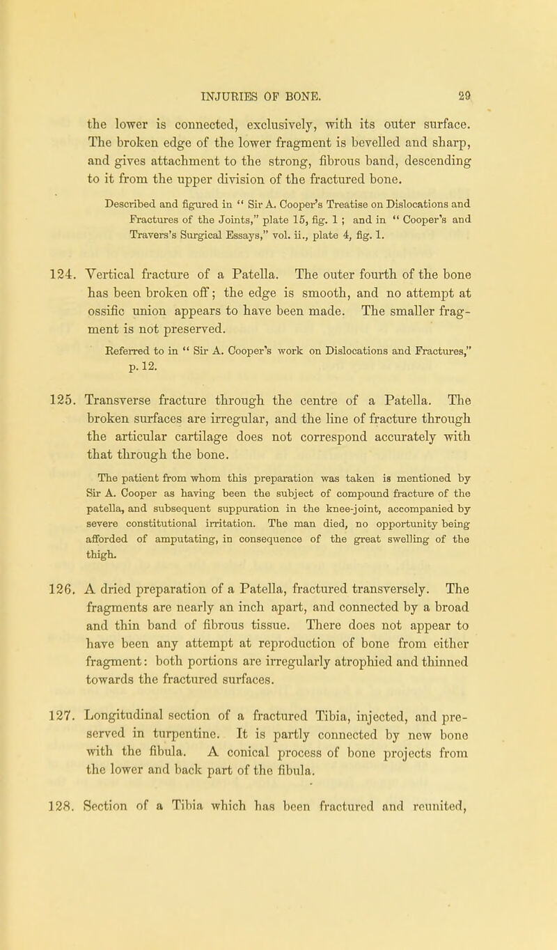the lower is connected, exclusively, witli its outer surface. The broken edge of the lower fragment is bevelled and sharp, and gives attachment to the strong, fibrous band, descending to it from the upper division of the fractured bone. Described and figured in  Sir A. Cooper's Treatise on Dislocations and Fractvires of the Joints, plate 16, fig. 1 ; and in  Cooper's and Travers's Surgical Essays, vol. ii., plate 4, fig. 1. 124. Vertical fracture of a Patella. The outer fourth of the bone has been broken off; the edge is smooth, and no attempt at ossific union appears to have been made. The smaller frag- ment is not preserved. Referred to in  Sir A. Cooper's work on Dislocations and Fractures, p. 12. 125. Transverse fracture through the centre of a Patella. The broken sui-faces are irregular, and the line of fracture through the articular cartilage does not correspond accurately with that through the bone. The patient from whom this preparation was taken is mentioned by Sir A. Cooper as having been the subject of compound fracture of the patella, and subsequent suppuration in the knee-joint, accompanied by severe constitutional irritation. The man died, no opportunity being afforded of amputating, in consequence of the great swelling of the thigh. 126. A dried preparation of a Patella, fractured transversely. The fragments are nearly an inch apart, and connected by a broad and thin band of fibrous tissue. There does not appear to have been any attempt at reproduction of bone from either fragment: both portions are irregularly atrophied and thinned towards the fractured surfaces. 127. Longitudinal section of a fractured Tibia, injected, and pre- served in turpentine. It is partly connected by new bone with the fibula. A conical process of bone projects from the lower and bade part of the fibula. 128. Section of a Tibia which has been fractured and reunited,