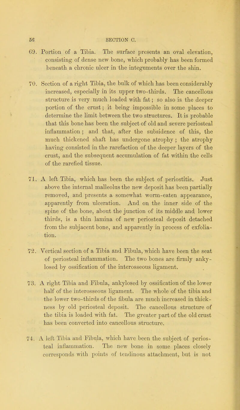 69. Portion of a Tibia. The surface jsresents an oval elevation, consisting of dense new bone, wliicli probably has been formed beneath a chronic nicer in the integuments over the shin. 70. Section of a right Tibia, the bulk of which has been considerably increased, especially in its upper two-thirds. The cancellous structure is very much loaded with fat; so also is the deeper portion of the crust; it being impossible in some places to determine the limit between the two stnictures. It is probable that this bone has been the subject of old and severe periosteal inflammation ; and that, after the subsidence of this, the much thickened shaft has undergone atrojahy ; the atrophy having consisted in the rarefaction of the deeper layers of the crust, and the subsequent accumulation of fat within the cells of the rarefied tissue. 71. A left Tibia, which has been the subject of periostitis. Just above the internal malleolus the new deposit has been partially removed, and presents a somewhat worm-eaten appearance, apparently from ulceration. And on the inner side of the spine of the bone, about the junction of its middle and lower thirds, is a thin lamina of new periosteal deposit detached from the subjacent bone, and apparently in process of exfolia- tion. 72. Vertical section of a Tibia and Fibula, which have been the seat of periosteal inflammation. The two bones are firmly anlcy- losed by ossification of the interosseous ligament. 73. A right Tibia and Fibula, ankylosed by ossification of the lower half of the interosseous ligament. The whole of the tibia and the lower two-thirds of the fibula are much increased in thick- ness by old periosteal deposit. The cancellous structure of the tibia is loaded with fat. The greater part of the old crust has been converted into cancellous structm-e. 74. A left Tibia and Fibula, wliich have been the subject of perios- teal inflammation. The new bone in some places closely corresponds with points of tendinous attachment, but is not