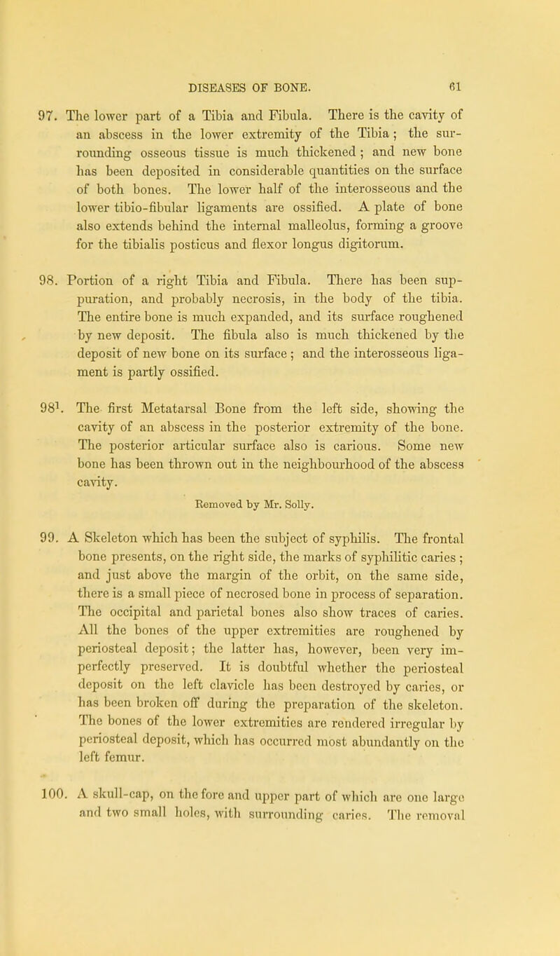 97. The lower part of a Tibia and Fibula. There is the cavity of an abscess in the lower extremity of the Tibia; the sur- rounding osseous tissue is much thickened; and new bone has been deposited in considerable quantities on the surface of both bones. The lower half of the interosseous and the lower tibio-fibular ligaments are ossified. A plate of bone also extends behind the internal malleolus, forming a groove for the tibialis posticus and flexor longus digitorum. 98. Portion of a right Tibia and Fibula. There has been sup- puration, and probably necrosis, in the body of the tibia. The entire bone is much expanded, and its surface roughened by new deposit. The fibula also is much thickened by the deposit of new bone on its surface ; and the interosseous liga- ment is partly ossified. 98^. The fii'st Metatarsal Bone from the left side, showing the cavity of an abscess in the posterior extremity of the bone. The posterior articular surface also is carious. Some new bone has been thrown out in the neighboui'hood of the abscess cavity. Kemoved by Mr. Solly. 99. A Skeleton which has been the subject of syphilis. The frontal bone presents, on the right side, the marks of syphilitic caries ; and just above the margin of the orbit, on the same side, there is a small piece of necrosed bone in process of separation. The occipital and parietal bones also show traces of caries. All the bones of the upper extremities are roughened by periosteal deposit; the latter has, however, been very im- perfectly preserved. It is doubtful whether the periosteal deposit on the left clavicle has been destroyed by caries, or has been broken off during the preparation of the skeleton. The bones of the lower extremities are rendered irregular by periosteal deposit, which has occurred most abundantly on the left femur. 100. A skull-cap, on the fore and upper part of which are one large and two small holes, with suiTOunding caries. 1'he removal