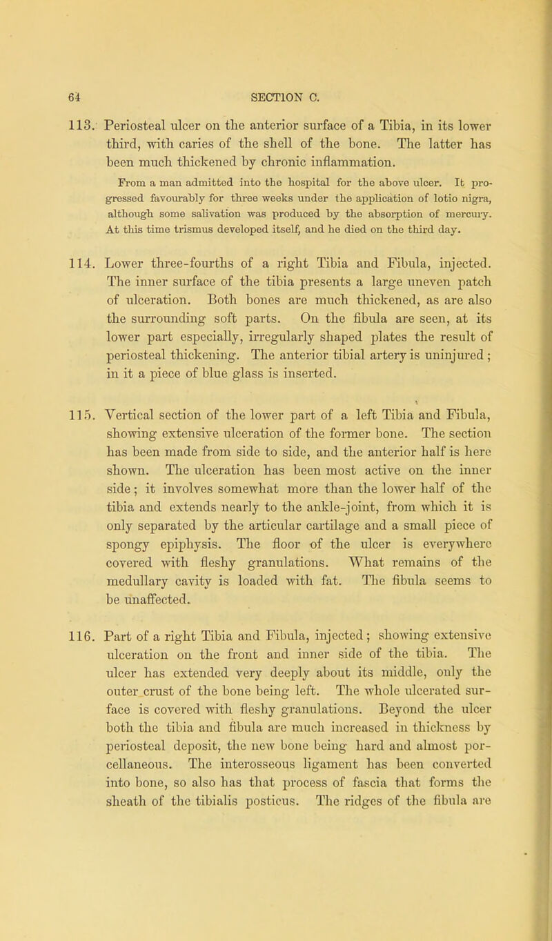 113. • Periosteal ulcer on tlie anterior surface of a Tibia, in its lower third, with caries of the shell of the bone. The latter has been much thickened by chronic inflammation. Fi-om a man admitted into the hospital for the above ulcer. It pro- gressed favoiirably for thi-ee weeks under the application of lotio nigra, although some salivation was produced by the absorption of mercmy. At this time trismus developed itself, and he died on the third day. 114. Lower three-fourths of a right Tibia and Fibula, injected. The inner surface of the tibia presents a large uneven patch of ulceration. Both bones are much thickened, as are also the surrounding soft parts. On the fibula are seen, at its lower part especially, irregularly shaped plates the result of periosteal thickening. The anterior tibial artery is uninjured ; in it a piece of blue glass is inserted. 11.5. Vertical section of the lower part of a left Tibia and Fibula, showing extensive ulceration of the former bone. The section has been made from side to side, and the anterior half is here shown. The ulceration has been most active on the inner side; it involves somewhat more than the lower half of the tibia and extends nearly to the ankle-joint, from which it is only separated by the articular cartilage and a small piece of spongy epiphysis. The floor of the ulcer is everywhere covered with fleshy granulations. What remains of the medullary cavity is loaded with fat. Tlie fibula seems to be unaffected. 116. Part of a right Tibia and Fibula, injected; showing extensive ulceration on the front and inner side of the tibia. Tlie ulcer has extended very deeply about its middle, only the outer_crust of the bone being left. The whole ulcerated sur- face is covered with fleshy granulations. Beyond the ulcer both the tibia and fibula are much increased in thickness by periosteal deposit, the new bone being hard and almost por- cellaneous. The interosseous ligament has been converted into bone, so also has that process of fascia that forms the sheath of the tibialis posticus. The ridges of the fibula are