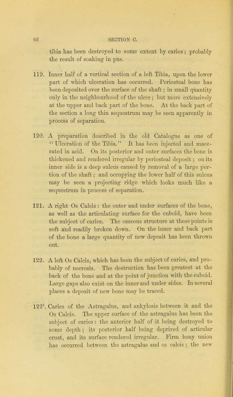 tibia has been destroyed to some extent by caries ; probably the result of soaking in pns. 119. Inner half of a vertical section of a left Tibia, upon tbe lower part of whicb ulceration has occurred. Periosteal bone has been deposited over the surface of the shaft; in small quantity only in the neighbourhood of the ulcer; but more extensively at the upper and back part of the bone. At the back part of the section a long thin sequestram may be seen apparently in process of separation. 120. A preparation described in the old Catalogue as one of  Ulceration of the Tibia. It has been injected and mace- rated in acid. On its posterior and outer surfaces the bone is thickened and rendered irregular by periosteal deposit; on its inner side is a deep sulcus caused by removal of a large por- tion of the shaft; and occupying the lower half of this sulcus may be seen a projecting ridge which looks much like a sequestrum in process of separation. 121. A right Os Calcis : the outer and under surfaces of the bone, as well as the articulating surface for the cuboid, have been the subject of caries. The osseous structure at these points is soft and readily broken down. On the inner and back part of the bone a large quantity of new deposit has been thi-own out. 122. A left Os Calcis, which has been the subject of caries, and pro- bably of necrosis. The destruction has been greatest at the back of the bone and at the point of junction with the cuboid. Large gaps also exist on the inner and under sides. In several places a deposit of new bone may be traced. 122^. Caries of the Astragakis, and ankylosis between it and the Os Calcis. The upper surface of the astragalus has been the subject of caries: the anterior half of it being destroyed to some depth; its posterior half being deprived of articular crust, and its surface rendered irregular. Firm bony union has occurred between the astragalus and os calcis ; the new