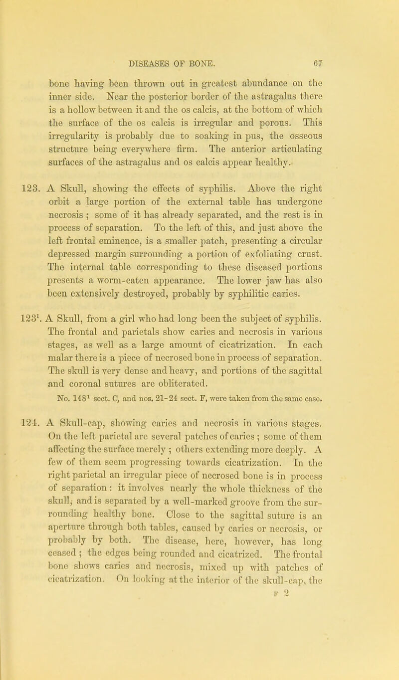 bone having been thrown out in greatest abundance on the inner side. Near the posterior border of the astragalus there is a hollow between it and the os calcis, at the bottom of which the surface of the os calcis is irregular and porous. Tliis irregularity is probably due to soaking in pus, the osseous structiu'e being everywhere firm. The anterior articulating smfaces of the astragalus and os calcis appear healthy. 123. A Skull, showing the effects of syphilis. Above the right orbit a large portion of the external table has undergone necrosis ; some of it has already separated, and the rest is in process of separation. To the left of this, and just above the left frontal eminence, is a smaller patch, presenting a circular depressed margin sm-rounding a portion of exfoliating crust. The internal table corresponding to these diseased portions presents a worm-eaten appearance. The lower jaw has also been extensively destroyed, probably by syphilitic caries. 123*. A Skull, fi-om a girl who had long been the subject of syphilis. The frontal and parietals show caries and necrosis in various stages, as well as a large amount of cicatrization. In each malar there is a piece of necrosed bone in process of separation. The skull is very dense and heavy, and portions of the sagittal and coronal sutures are obliterated. No. 148^ sect. C, and nos. 21-24 sect. F, were taken from the same case. 12-1. A Skull-cap, showing caries and necrosis in various stages. On the left paiietal are several patches of caries ; some of tliem affecting the surface merely ; others extending more deeply. A few of them seem progressing towards cicatrization. In the right parietal an irregular piece of necrosed bone is in process of separation : it involves nearly the whole thickness of the skull j and is separated by a well-marked groove from the sur- rounding healthy bone. Close to the sagittal suture is an aperture through both tables, caused by caries or necrosis, or probably by both. The disease, liere, however, has long ceased ; the edges being rounded and cicatrized. The frontal Ijonc shows caries and necrosis, mixed up with patches of cicatrization. On looking at the interior of the skull-cnp, the
