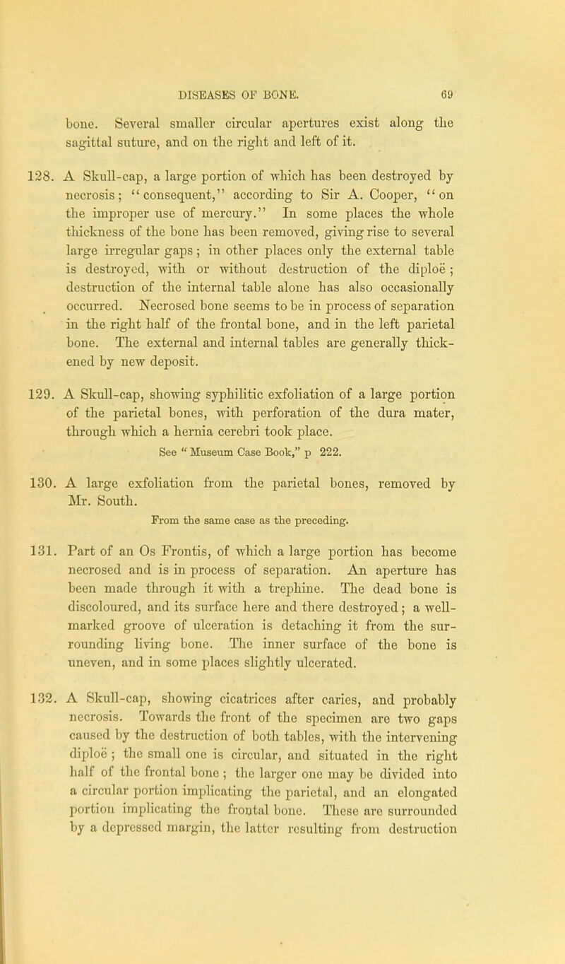 bone. Several smaller circular apertures exist along tlie sagittal sutiu'e, and on tlie right and left of it. 128. A Skull-cap, a large portion of which has been destroyed by- necrosis ; consequent, according to Sir A. Coopei, on the improper use of mercuiy. In some places the whole tliickncss of the bone has been removed, giving rise to several large irregular gaps; in other places only the external table is destroyed, with or without destruction of the diploe ; destruction of the internal table alone has also occasionally occurred. Necrosed bone seems to be in process of separation in the right half of the frontal bone, and in the left parietal bone. The external and internal tables are generally thick- ened by new deposit. 129. A Skull-cap, showing syphilitic exfoliation of a large portion of the parietal bones, with perforation of the dura mater, through which a hernia cerebri took place. See  Museum Case Book, p 222. 130. A large exfoliation from the parietal bones, removed by Mr. South. From the same case as the preceding. 131. Part of an Os Frontis, of which a large portion has become necrosed and is in process of separation. An aperture has been made through it with a trephine. The dead bone is discoloured, and its surface here and there destroyed; a well- marked groove of ulceration is detaching it from the sur- rounding living bone. Tlie inner surface of the bone is uneven, and in some places slightly ulcerated. 132. A Skull-cap, showing cicatrices after caries, and probably necrosis. Towards the front of the specimen are two gaps caused by the destruction of both tables, with the intervening diploe ; the small one is circular, and situated in the right half of the frontal bono ; the larger one may bo divided into a circular portion implicating the parietal, and an elongated portion implicating the frontal bone. These are surrounded by a depressed margin, the latter resulting from destruction