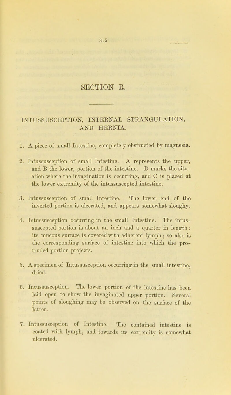 SECTION R. INTUSSUSCEPTION, INTERNAL STRANGULATION, AND HERNIA. 1. A piece of small Intestine, completely obstructed by magnesia. 2. Intussusception of small Intestine. A represents the upper, and B the lower, portion of the intestine. D marks the situ- ation where the invagination is occurring, and C is j)laced at the lower extremity of the intussuscepted intestine. 3. Intussusception of small Intestine. The lower end of the inverted portion is ulcerated, and appears somewhat sloughy. 4. Intussusception occumng in the small Intestine. The intus- suscepted portion is about an inch and a quarter in length: its mucous surface is covered with adherent lymph ; so also is the corresponding surface of intestine into which the pro- truded portion projects. 5. A specimen of Intussusception occurring in the small intestine, dried. 6. Intussusception. The lower portion of the intestine has been laid open to show the invaginated upper portion. Several points of sloughing may be observed on the surface of the latter. 7. Intussusception of Intestine. Tlie contained intestine is coated with lymph, and towards its extremity is somewhat ulcerated.
