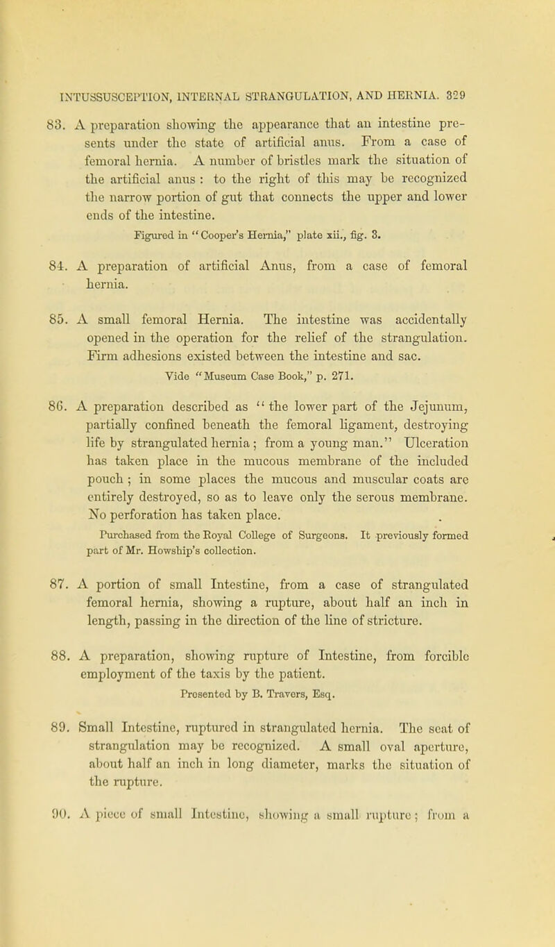 83. A preparation showing the appearance that an intestine pre- sents under the state of artificial anus. From a case of femoral hernia. A number of bristles mark the situation of the artificial anus : to the right of this may be recognized the narrow portion of gut that connects the upper and lower ends of the intestine. Figured in Cooper's Hernia, jjlate xii., fig. 3. 84. A preparation of artificial Anus, from a case of femoral hernia. 85. A small femoral Hernia. The intestine was accidentally opened in the operation for the relief of the strangulation. Firm adhesions existed between the intestine and sac. Vide Museum Case Book, p. 271. 8G. A preparation described as the lower part of the Jejunum, partially confined beneath the femoral ligament, destroying life by strangulated hernia ; from a young man. Ulceration has taken place in the mucous membrane of the included pouch ; in some places the mucous and muscular coats are entirely destroyed, so as to leave only the serous membrane. No perforation has taken place. Pvirchased from the Royal College of Surgeons. It previously formed part of Mr. Howship's collection. 87. A portion of small Intestine, from a case of strangulated femoral hernia, showing a rupture, about half an inch in length, passing in the direction of the line of stricture. 88. A preparation, showing rupture of Intestine, from forcible employment of the taxis by the patient. Presented by B, Travors, Esq. 89. Small Intestine, mptured in strangulated hernia. The scat of strangulation may be recognized. A small oval aperture, about half an inch in long diameter, marks the situation of the rupture. 90. A piece of small Intestine, showing a small rupture; from a