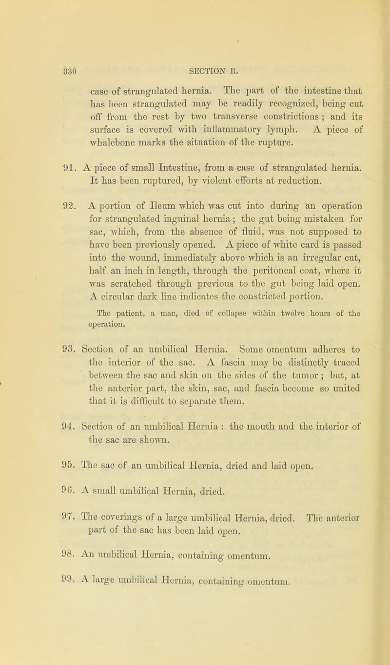 case of strangulated hernia. The jjart of the intestine that has been strangulated may be readily recognized, being cut off from the rest by two transverse constrictions ; and its surface is covered vsdth inflammatory lymph. A piece of whalebone marks the situation of the rupture. 91. A piece of small Intestine, from a case of strangulated hernia. It has been ruptured, by violent efforts at reduction. 92. A portion of Ileum which was cut into during an operation for strangulated inguinal hernia; the gut being mistaken for sac, which, from the absence of fluid, was not supposed to have been previously opened. A piece of white card is passed into the wound, immediately above which is an irregular cut, half an inch in length, through the j^eritoneal coat, where it was scratched through previous to the gut being laid open. A circular dark line indicates the constricted portion. The patient, a man, died of collapse within twelve hours of the operation. 93. Section of an umbilical Hernia. Some omentum adheres to the interior of the sac. A fascia may be distinctly traced between the sac and skin on the sides of the tumor ; but, at the anterior part, the skin, sac, and fascia become so united that it is difficult to separate them. 94.. Section of an umbilical Hernia : the mouth aud the interior of the sac are shown. 95. The sac of an umbilical Hernia, dried and laid open. 96. A small umbilical Hernia, dried. 97. The coverings of a large umbilical Hernia, dried. The anterior part of the sac has been laid open. 98. An umbilical Hernia, containing omentum. 99. A large umbilical Hernia, containing omentum.