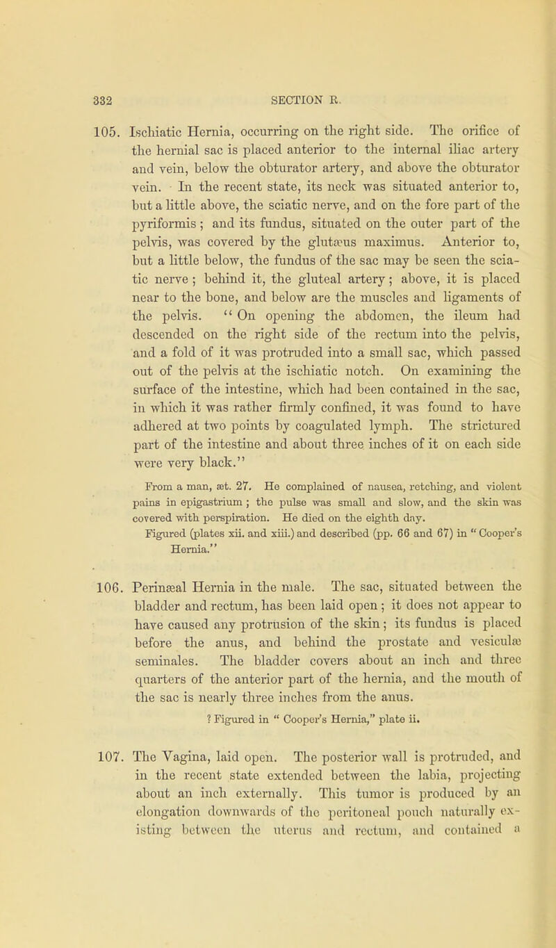 105. Iscliiatic Hernia, occurring on the right side. The orifice of the hernial sac is placed anterior to the internal ihac artery and vein, below the obturator artery, and above the obturator vein. In the recent state, its neck vras situated anterior to, but a little above, the sciatic nerve, and on the fore part of the pyriformis ; and its fundus, situated on the outer part of the pelvis, vras covered by the gluta^us maximus. Anterior to, but a little below, the fundus of the sac may be seen the scia- tic nerve ; behind it, the gluteal artery; above, it is placed near to the bone, and below are the muscles and ligaments of the pelvis.  On opening the abdomen, the ileum had descended on the right side of the rectum into the pelvis, and a fold of it was protruded into a small sac, which passed out of the pelvis at the ischiatic notch. On examining the surface of the intestine, which had been contained in the sac, in which it was rather firmly confined, it was found to have adhered at two points by coagulated lymph. The strictured part of the intestine and about three inches of it on each side were very black. From a man, set. 27. He complained of nausea, retching, and violent pains in epigastrium; the pulse was small and slow, and the skin was covered with perspiration. He died on the eighth dnj. Figured (plates xii. and xiii.) and described (pp. 66 and 67) in  Cooper's Hernia. 106. Perinteal Hernia in the male. The sac, situated between the bladder and rectum, has been laid open; it does not appear to have caused any protrusion of the skin; its fimdus is placed before the anus, and behind the prostate and vesicula) seminales. The bladder covers about an inch and three quarters of the anterior part of the hernia, and the mouth of the sac is nearly three inches from the aims. ? Figured in  Cooper's Hernia, plate ii. 107. The Vagina, laid open. The posterior wall is protruded, and in the recent state extended between the labia, projecting about an inch externally. This tumor is produced by an elongation downwards of the peritoneal pouch naturally ex- isting between the uterus and rectum, and contained a