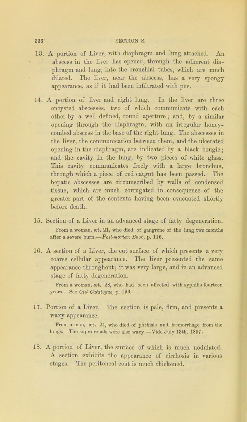 13. A portion of Liver, with diaphragm and lung attached. An abscess in the liver has opened, through the adherent dia- phragm and lung, into the bronchial tubes, which are much dilated. The liver, near the abscess, has a very spongy appearance, as if it had been infiltrated with pus. 14. A portion of Hver and right lung. In the liver are three encysted abscesses, two of which communicate vfith. each other by a well-defined, round aperture ; and, by a similar opening through the diaphragm, with an irregular honey- combed abscess in the base of the right lung. The abscesses in the liver, the communication between them, and the ulcerated opening in the diaphragm, are indicated by a black bougie; and the cavity in the lung, by two pieces of white glass. This cavity communicates freely with a large bronchus, through which a piece of red catgut has been passed. The hepatic abscesses are circumscribed by walls of condensed tissue, which are much corrugated in consequence of the greater part of the contents having been evacuated shortly before death. 15. Section of a Liver in an advanced stage of fatty degeneration. From a woman, set. 21, who died of gangrene of the lung two months after a severe bum.—Post-mortem Book, p. 116. 16. A section of a Liver, the cut surface of which presents a very coarse cellular appearance. The liver presented the same appearance throughout; it was very large, and in an advanced stage of fatty degeneration. From a woman, eet. 28, who had been affected with syphilis fourteen years.—See Old Catalogue, p. 196. 17. Portion of a Liver. The section is pale, firm, and j^resents a waxy appearance. From a man, rot. 24, who died of phthisis and hsemon-hago from the lungs. The supra-renals were also waxy.—Vide July 13th, 1857. 18. A portion of Liver, the surface of which is much nodulated. A section exhibits the appearance of cirrhosis in various stages. Tlic peritoneal coat is much thickened.