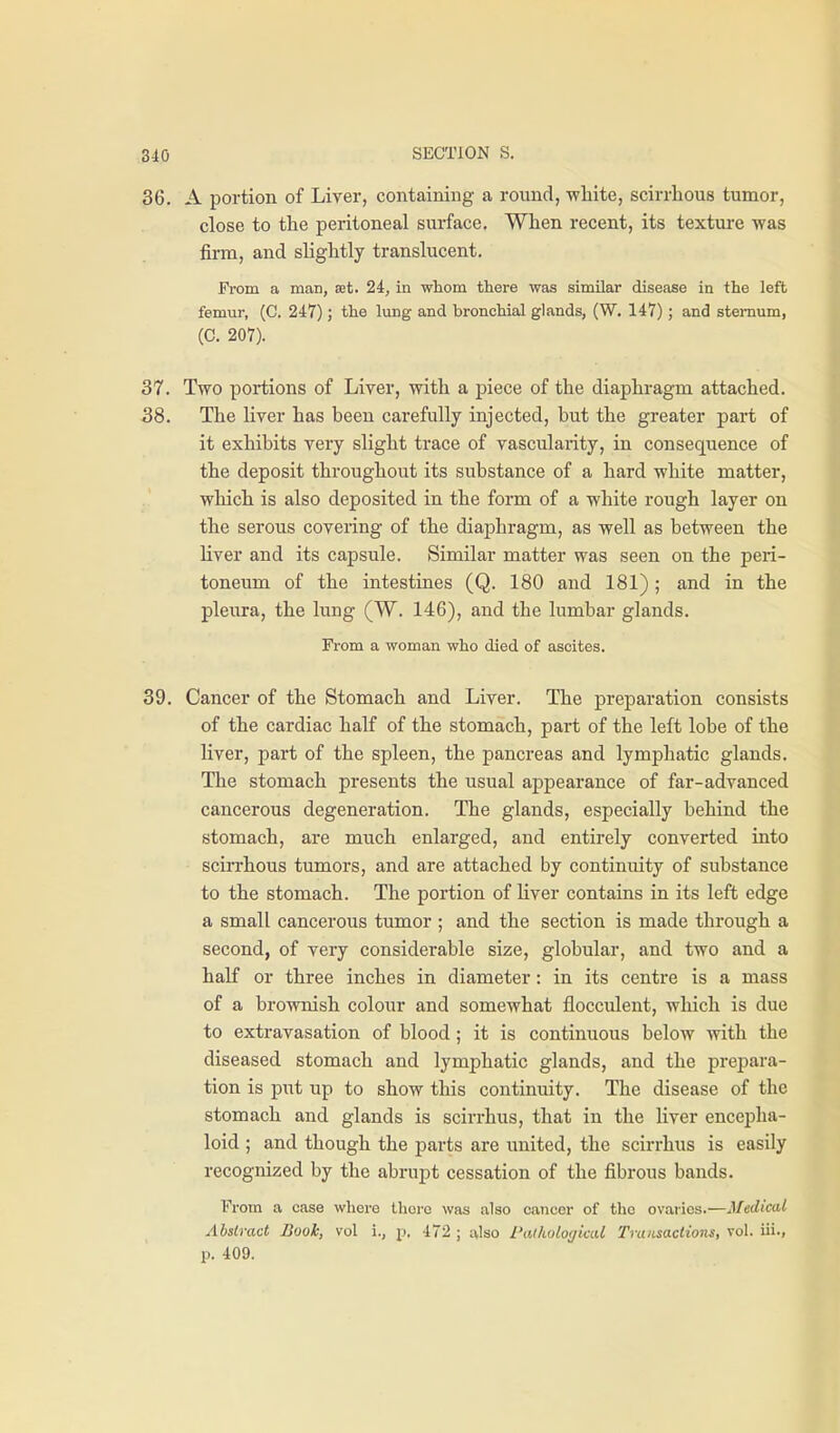 36. A portion of Liver, containing a round, white, scirrhous tumor, close to the peritoneal surface. When recent, its texture was firm, and slightly translucent. From a maB, £et. 24, in whom there was similar disease in the left femur, (C. 247); the lung and bronchial glands, (W. 147) ; and sternum, (C. 207). 37. Two portions of Liver, with a piece of the diaphragm attached. 38. The liver has been carefully injected, but the greater part of it exhibits very slight trace of vascularity, in consequence of the deposit throughout its substance of a hard white matter, wliich is also deposited in the form of a white rough layer on the serous covering of the diaphragm, as well as between the liver and its capsule. Similar matter was seen on the peri- toneum of the intestines (Q. 180 and 181); and in the pleura, the lung (W. 146), and the lumbar glands. From a woman who died of ascites. 39. Cancer of the Stomach and Liver. The preparation consists of the cardiac half of the stomach, part of the left lobe of the liver, part of the spleen, the pancreas and lymphatic glands. The stomach presents the usual appearance of far-advanced cancerous degeneration. The glands, especially behind the stomach, are much enlarged, and entirely converted into scirrhous tumors, and are attached by continuity of substance to the stomach. The portion of Uver contains in its left edge a small cancerous tumor ; and the section is made through a second, of very considerable size, globular, and two and a half or three inches in diameter: in its centre is a mass of a brownish coloi;r and somewhat flocculent, which is due to extravasation of blood; it is continuous below with the diseased stomach and lymphatic glands, and the prepara- tion is put up to show this continuity. The disease of the stomach and glands is scirrhus, that in the liver encepha- loid ; and though the parts are united, the scirrhus is easily recognized by the abrupt cessation of the fibrous bands. From a case where Ihoi-o was also cancer of the ovaries.—Medical Abstract Book, vol i., p. 472 ; also Pai/iolo(/iml Transactions, vol. iii., p. 409.