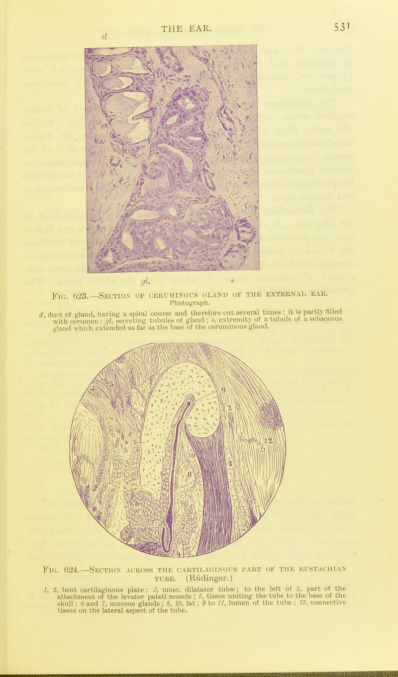 d .//. Fic. (i23.—.Section uk cKRi'Mixars ciland of thk external eak. Phototfraph. d duet of land, haviii); a spiral course and therefore eut several times : it is partly filled ' with cerumen : '//, seeretiiiif lid)nles of t'land ; «, extremity of a tubule of a sebaceous t'land which extended as far as the base of the ceruminous jfland. Fui. ()24.—.Section acr(jss the cahtii.aoinous i'akt of the eustachian TUBE. (Rudinger.) bent cartilaginous plate: nuisc. dilatator tuba); to the left of I,, part of the attachment of the levator palati muscle ; 5, tissue uniting the tube to the base of the skull ; r, and 7, nmcous glands; 8, 10, fat; 9 to II, lumen of the tube ; connective tissue on the lateral aspect of the tube.