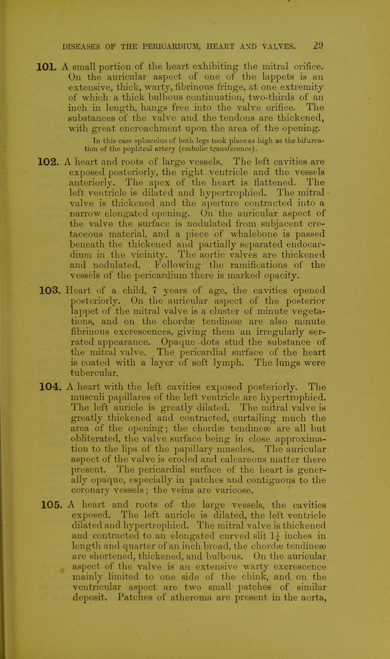 101. A small portion of the heart exhibiting the mitral orifice. On the auricular aspect of one of the lappets is an extensive, thick, warty, fibrinous fringe, at one extremity of which a thick bulbous continuation, two-thirds of an inch in length, hangs free into the valve orifice. The substances of the valve and the tendons are thickened, with great encroachment upon the area of the opening. In this case sphacelus of both legs took place as liigh as the bifurca- tion of the popliteal artery (embolic t^-ansference). 102. A heart and roots of large vessels. The left cavities are exposed posteriorly, the right ventricle and the vessels anteriorly. The apex of the heart is flattened. The left ventricle is- dilated and hypertrophied. The mitral ■ valve is thickened and the aperture contracted into a narrow elongated opening. On the auricular aspect of the valve the surface is nodulated from subjacent cre- taceous material, and a piece of whalebone is passed beneath the thickened and partially separated endocar- dium in the vicinity. The aortic valves are thickened and nodulated. Following the ramifications of the vessels of the pericardium there is marked opacity. 103. Heart of a child, 7 years of age, the cavities opened posteriorly. On the auricular aspect of the posterior lappet of the mitral valve is a cluster of minute vegeta- tions, and on the chordas tendmese are also minute fibrinous excrescences, giving them an irregularly ser- rated appearance. Opaque dots stud the substance of the mitral valve. The pericardial surface of the heart is coated with a layer of soft lymph. The lungs were tubercular, 104. A heart with the left cavities exposed posteriorly. The niusculi papillares of the left ventricle are hypertrophied. The left auricle is greatly dilated. The mitral valve is greatly thickened and contracted, curtailing much the area of the opening; the chordas tendineaa are all but obliterated, the valve surface being in close approxima- tion to the lips of the papillary muscles. The auricular aspect of the valve is eroded and calcareous matter there present. The pericardial surface of the heart is gener- ally opaque, especially in patches and contiguous to the coronary vessels ; the veins are varicose. 105. A heart and roots of the large vessels, the cavities exposed. The left auricle is dilated, the left ventricle dilated and hypeiiropliied. The mitral valve is thickened and contracted to an elongated curved slit 1^ inches in length and quarter of an inch broad, the chordai tendineaj are shortened, thickened, and bulbous. On the auricular aspect of the valve is an extensive warty excrescence mainly hmited to one side of the chink, and on the ventricular aspect are two small patches of similar deposit. Patches of atheroma are present in the aorta,